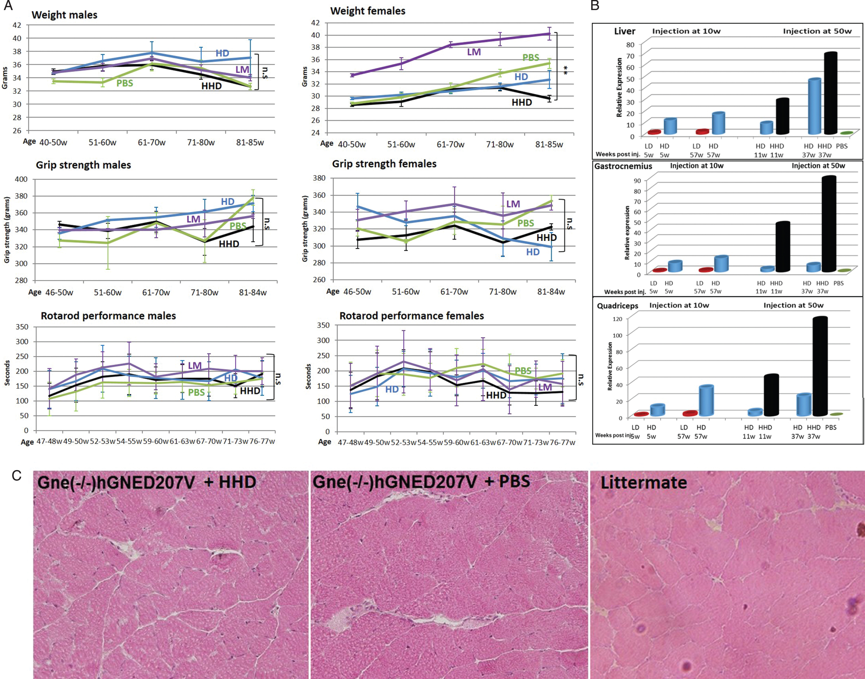 Functional efficacy of gene therapy and GNE expression in Gne(–/–) hGNED207V-Tg 50 week old treated mice. Weight, grip force and rotarod performance follow up of Gne(–/–) hGNED207V-Tg mice after systemic delivery of high dose (HD-1.1014 vg/kg) and higher dose (HHD-5.1014 vg/kg) of rAAVrh74MCKGNE viral vector to 50 week old mice; LM, littermate; PBS, Gne(–/–) hGNED207V-Tg mice injected with PBS. ** = p value < 0.01; ns = not significant. B. human wt GNE mRNA relative expression of the HD and HHD treated 50 week old Gne(–/–) hGNED207V-Tg mice (right panel), 11 and 37 weeks post injection, compared to the 10 week old injected mice (left panel); C. Representative H&E gastrocnemius histological section of a 50 week old treated Gne(–/–) hGNED207V-Tg mouse, 37 weeks after injection of an HHD dose of rAAVrh74MC.GNE viral vector.