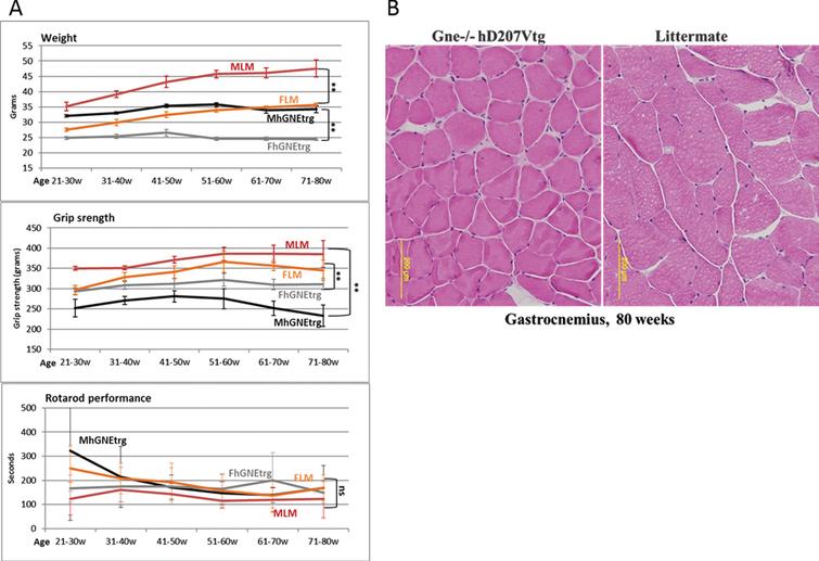 Muscle performance follow up of Gne(–/–) hGNED207V-Tg mice. A. Weight, grip force and rotarod performance follow up of Gne(–/–) hGNED207V-Tg mice; MLM, male littermate; FLM, female littermate; MhGNEtrg, male Gne(–/–) hGNED207V-Tg mice; FhGNEtrg, female male Gne(–/–) hGNED207V-Tg mice. B. Representative H&E gastrocnemius histological section of an 80 week old Gne(–/–) hGNED207V-Tg mouse and an 80 week old wt littermate.