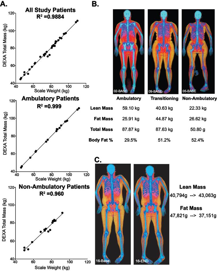 Evaluation of body composition using whole body DEXA in WSiMD. (A) Patients scale weight taken in clinic were compared to same day DEXA calculated total mass. The correlation between scale weight and DEXA-determined weight was slightly better for ambulatory patients. (B) Examples of participants at different disease stages upon enrollment into the study. (C) Example of participant who improved in the study with increasing muscle mass and lower fat mass.
