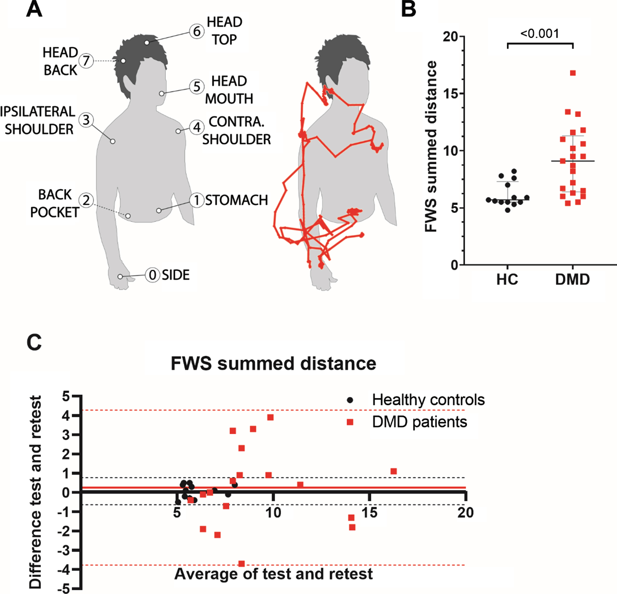 Functional Workspace (FWS) summed distance setup, construct validity and reliability. In (A) the seven upper extremity targets of the FWS are shown and alongside this a typical movement pattern of the right wrist during the FWS is presented in red. Construct validity and reliability of the summed hand length distance to these seven targets are shown in (B) and (C) respectively. This summed distance differed significantly between Duchenne muscular dystrophy (DMD) patients and healthy controls (HC; p < 0.001). The Bland-Altman plot with mean bias (straight lines) and 95%-confidence intervals (dotted lines) shows that reliability is high for HCs (round), but much lower for patients (square). Average of the two trials is plotted on the x-axis and difference between the trials on the y-axis.