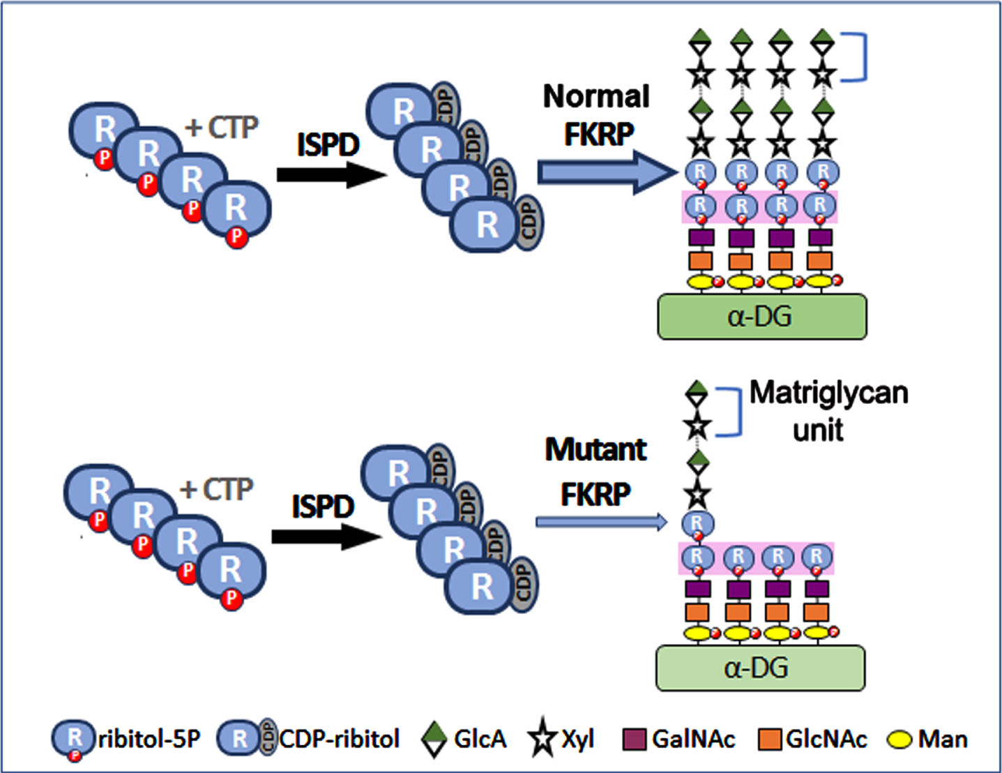 Effect of Normal and mutant FKRP function on glycosylation of α-DG. The structure of the laminin-binding O-mannosylated glycan of α-DG is delineated with the following chain: (3GlcA-β1-3Xyl-α1) n-3GlcA- β1-4Xyl-Rbo5P-1Rbo5P-3GalNAc- β1-3GlcNAc- β1-4(P-6) Man-1-Thr/ser. POMT1 and POMT2 catalyze the initial O-mannosylation. This is followed by the addition of GlcNAc, GalNAc and the first ribitol-5-phosphate (ribitol-5P) carried out by POMGnT2 (GTDC2), B3GALNT2 and FKTN respectively. FKRP adds a second ribitol-5P. The first Xyl and GlcA are added by TMEM5 and B4GAT1 successively. Finally, LARGE acts as a bifunctional glycosyltransferase having both xylosyltransferase and glucuronyltransferase activities, producing a repeated matriglycan units of 3Xylα1,3-GlcAβ1. ISPD is essential for synthesizing CDP-ribitol, the donor substrate for both FKRP and FKTN. FKRP with missense mutations retains partial function. Abbreviations: CTP, cytidine triphosphate; CDP, cytidine diphosphate; GalNAc, N-acetylgalactosamine; GlcA, glucuronic acid; GlcNAc, N-acetylglucosamine; Man, mannose; P, phosphate; Xyl, xylose; ISPD, isoprenoid synthase domain containing; FKTN, Fukutin; FKRP, Fukutin related protein.