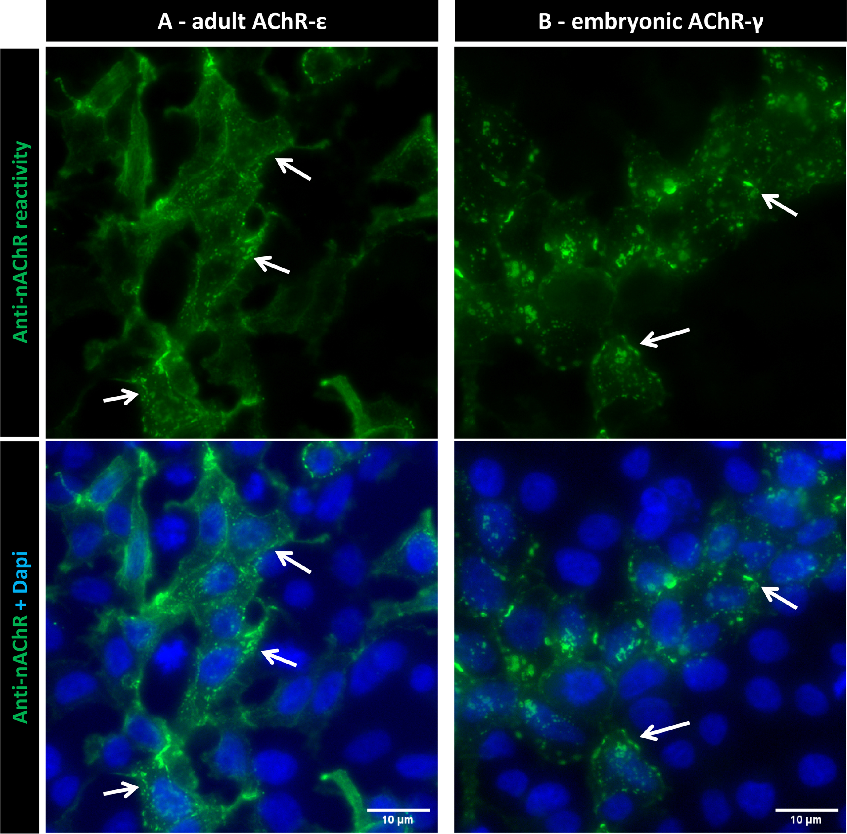 Anti-nAChR reactivity with Dapi counterstaining. Images from a representative positive sample indicating the localization of AChR clusters in the cytoplasmic membrane (arrows) in both adult (A) and embryonic (B) conformations. Scale bars = 10μm.