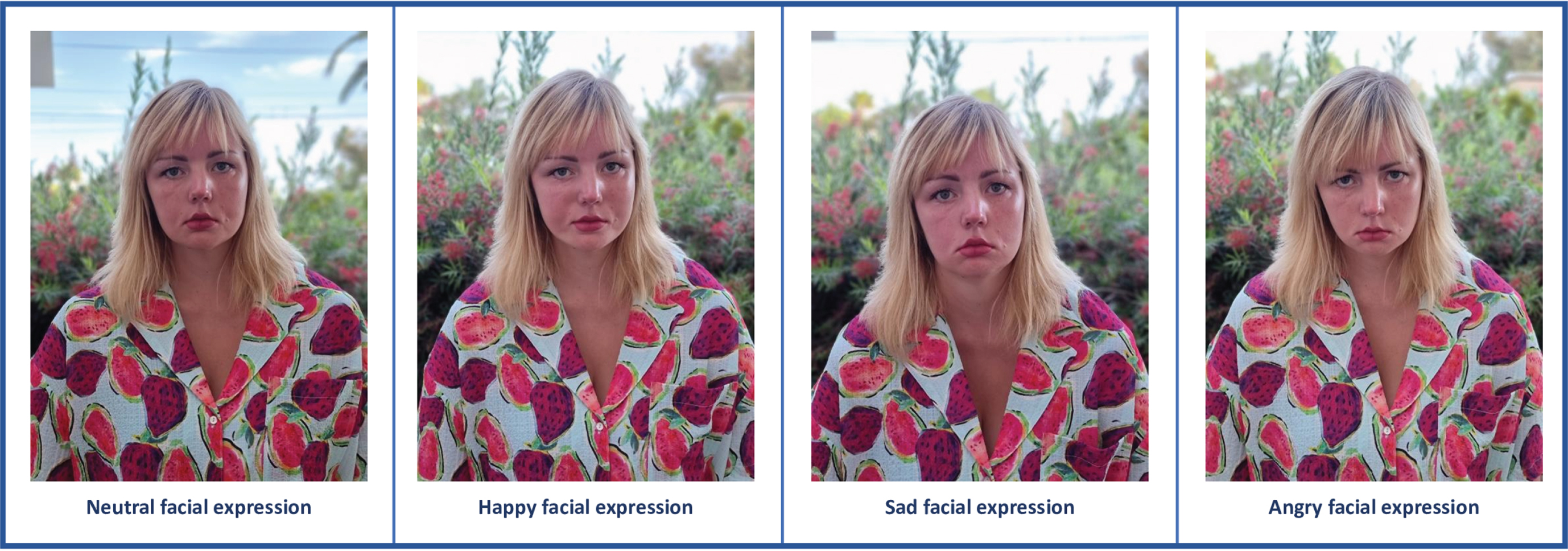 Facial expressions of a FSHD patient with facial weakness. These pictures are an example of facial expressions of a 27-year old FSHD patient with facial weakness in a neutral situation and during three primary emotions: happy, sadness and anger. Permission for usage of this pictures was granted by the patient.Adapted from ‘’Psychosocial functioning in patients with altered facial expression: a scoping review in five neurological diseases” by N.B. Rasing et al. 2023 [25].
