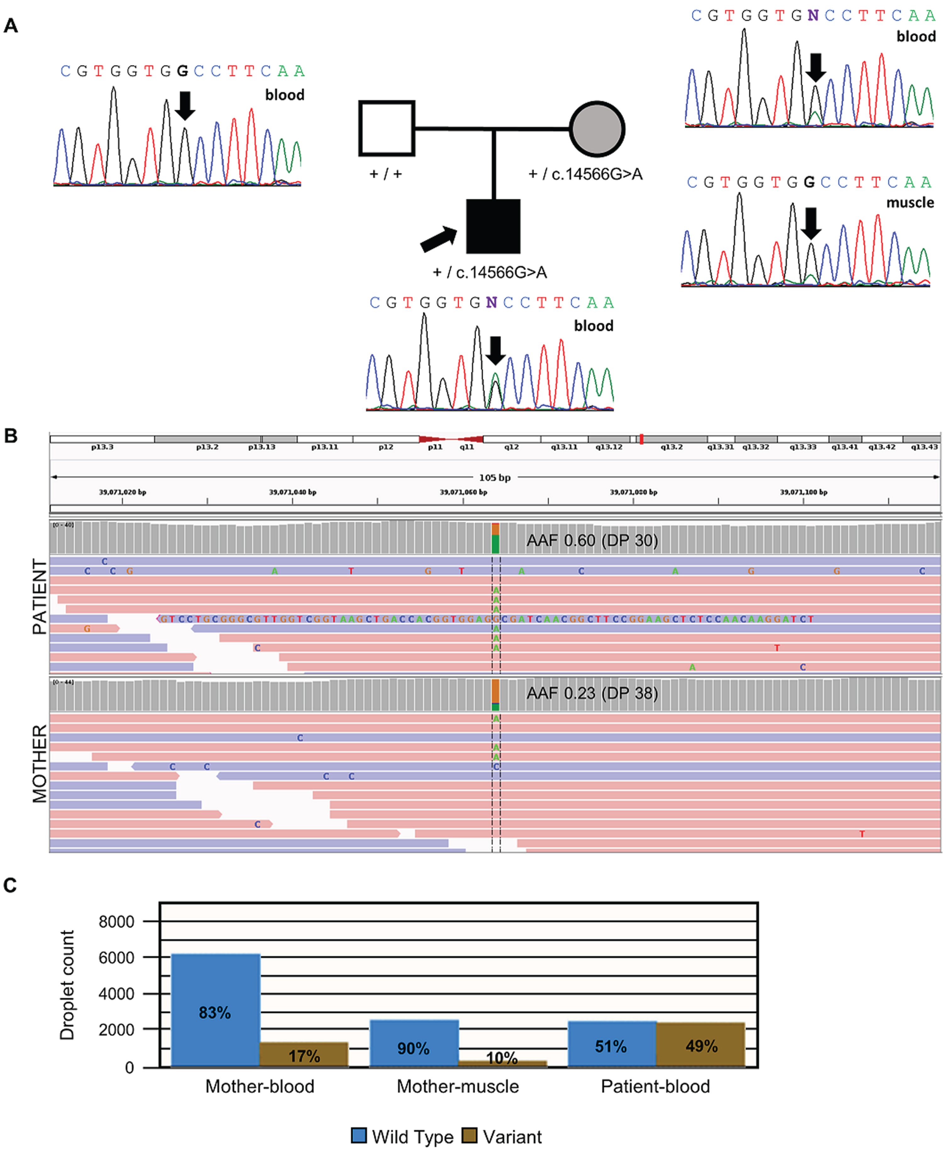 Molecular analysis of the RYR1 genetic variant. (A) The family pedigree and Sanger sequencing analysis. The electropherogram shows that the affected child is heterozygous for the RYR1(NM_000540.3):c.14566G > A variant (arrow). The asymptomatic mother was found to be also heterozygous when blood-derived DNA was analyzed. Nevertheless, the mosaicism is reflected in the small green peak not present in the father. The analysis of a second tissue (muscle-derived DNA) in the mother confirmed the mosaicism (again, a small green peak). (B) IGV screenshot of genome sequencing of the results from blood-derived DNA of the affected child and his mother, including the variant position Chr19:39,071,064 (hg19). Mother mosaicism is observed in the lower AAF (0.23) when compared to the child with congenital myopathy (0.60). (C) Droplet digital PCR results confirmed the mosaic condition of the mother. Abbreviations: AAF, alternative allele frequency; DP, depth.