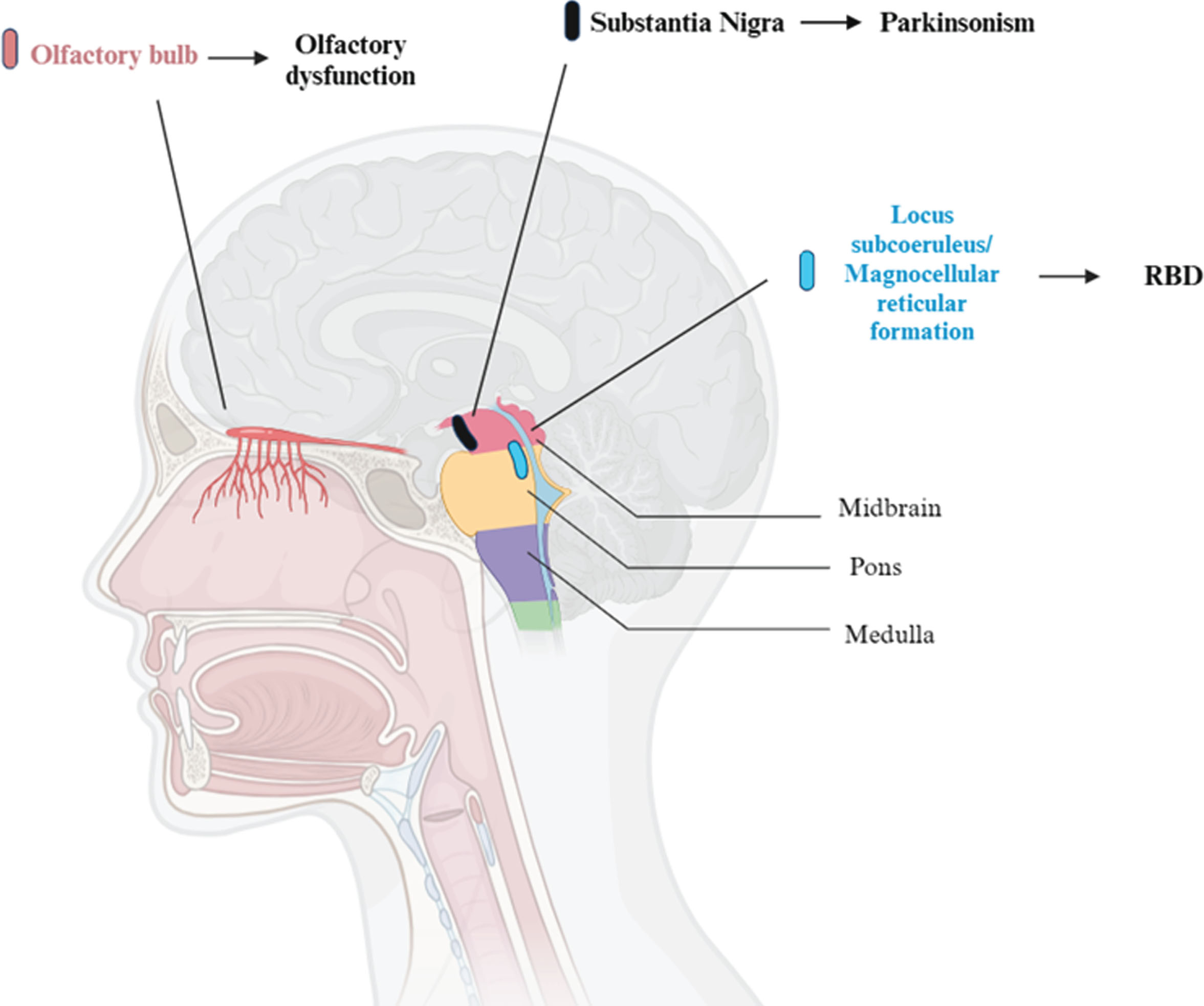 Brain areas involved in olfactory dysfunction, REM Behavior Disorder (RBD) and parkinsonism. So far, most of the research on this topic has been conduct on animals. This figure represents the human equivalent of regions in animal models, mainly in rats and cats. For what concerns REM motor control centers, in particular, the sublaterodorsalis nucleus (rats) and the peri-locus coeruleus alpha (cats) are responsible for muscle atonia in REM sleep. These regions correspond to the locus subcoeruleus and the magnocellular reticular formation area in humans.
