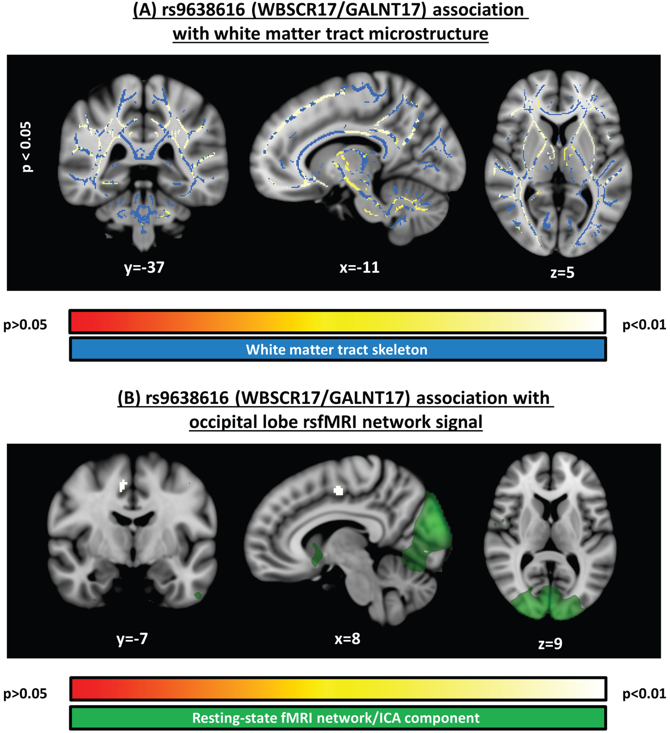 Significant clusters identified in voxelwise analyses. A) Structural MRI voxelwise analysis of white matter microstructure (fractional anisotropy), testing the association to rs9638616, corrected for multiple comparisons across voxels. B) Resting-state functional MRI voxelwise analysis, testing the association to rs9638616, corrected for multiple comparisons across voxels and independent components. Position of each slice is given in MNI152 coordinates. All images are shown with the radiological right-left convention.