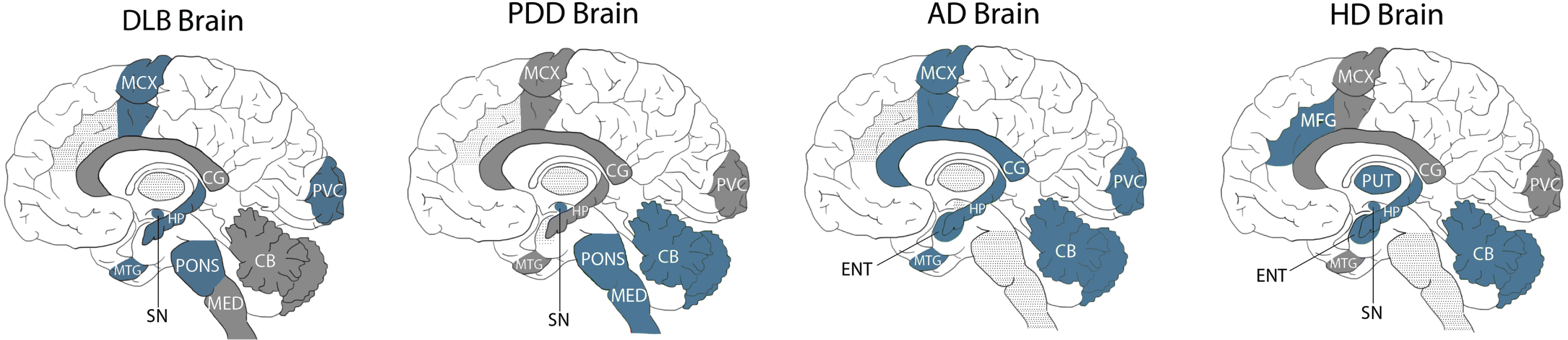 Comparison of pantothenic acid alterations in DLB, PDD, AD, and HD brains. Blue regions indicate decreases in pantothenic acid. Grey regions indicate no changes in pantothenic acid. Grey dotted shading indicates that region was not investigated in that condition. CB, Cerebellum; CG, Cingulate Gyrus; ENT, Entorhinal Cortex; HP, Hippocampus; MED, Medulla; MCX, Motor Cortex; MFG, Middle frontal gyrus; MTG, Middle Temporal Gyrus; PUT, Putamen; PVC, Primary visual cortex; SN, Substantia Nigra.