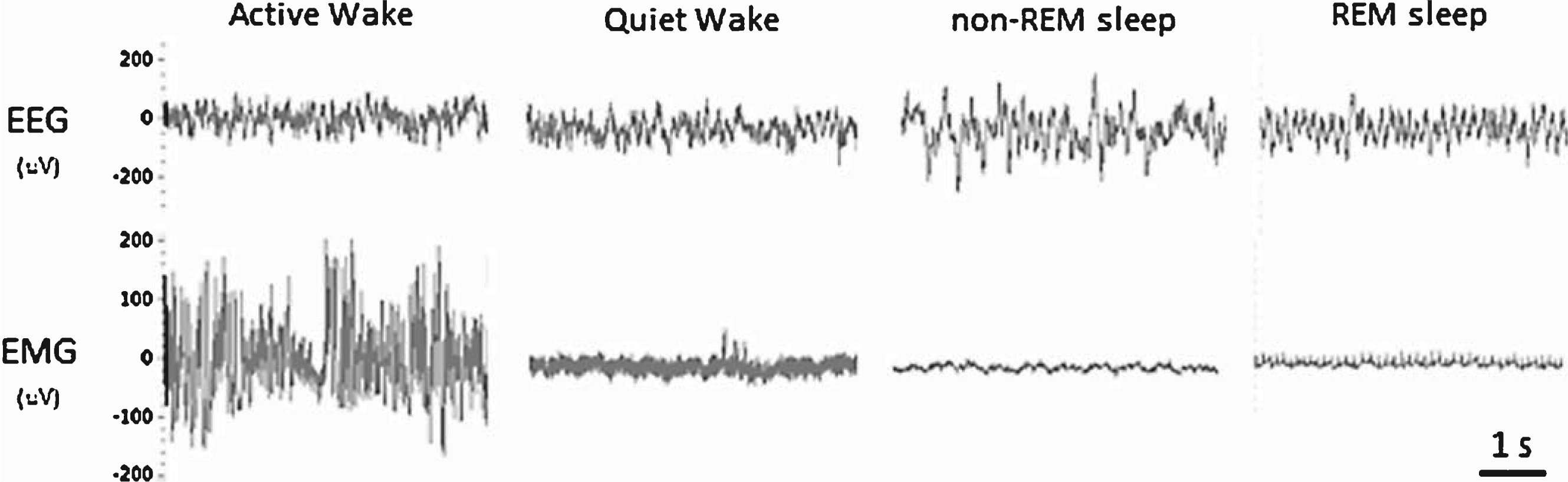 Representative examples of the EEG and EMG waveforms used for manually scoring the vigilant states of mice.