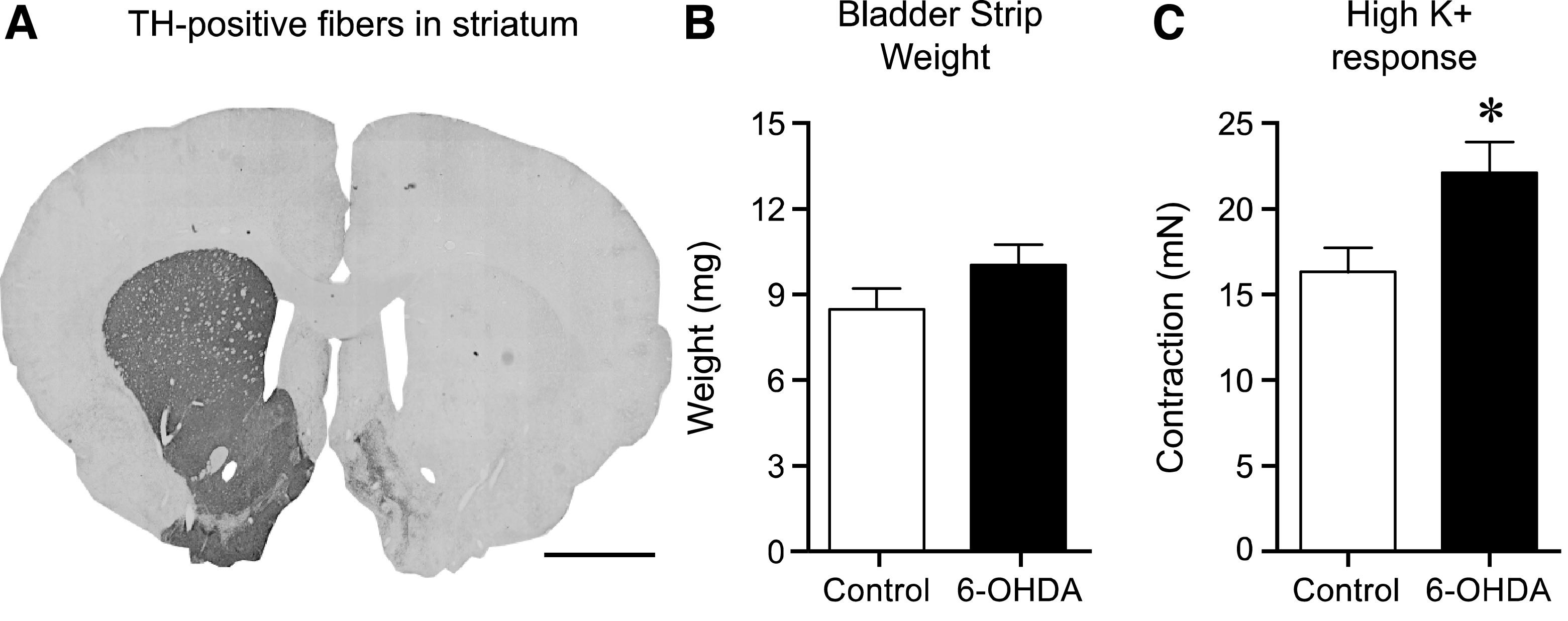The effect of 6-OHDA lesion on striatal tyrosine hydroxylase (TH)-positive fibers, bladder weight and contractile response to high K
+ Krebs. Following unilateral 6-OHDA lesion TH-positive fibers in the striatum were >95% abolished as compared to the untreated side (A). The bladder strip weight in the 6-OHDA-lesioned animals showed a trend to be larger (10.0±0.8 mg, n = 17) as compared to normal (8.4±0.8 mg, n = 34), however this 20% increase was not significant (p = 0.20, unpaired t-test; B). Testing the viability of the strips by using high K
+ Krebs solution revealed a significantly (36% ) higher response in the 6-OHDA-lesioned animals as compared to the untreated controls; 22.1±1.8 mN (n = 34) vs. 16.2±1.5 mN (n = 17) respectively (unpaired t-test p = 0.022; C). Scale bar in Panel A represents 2 mm.  * = significantly different from control.