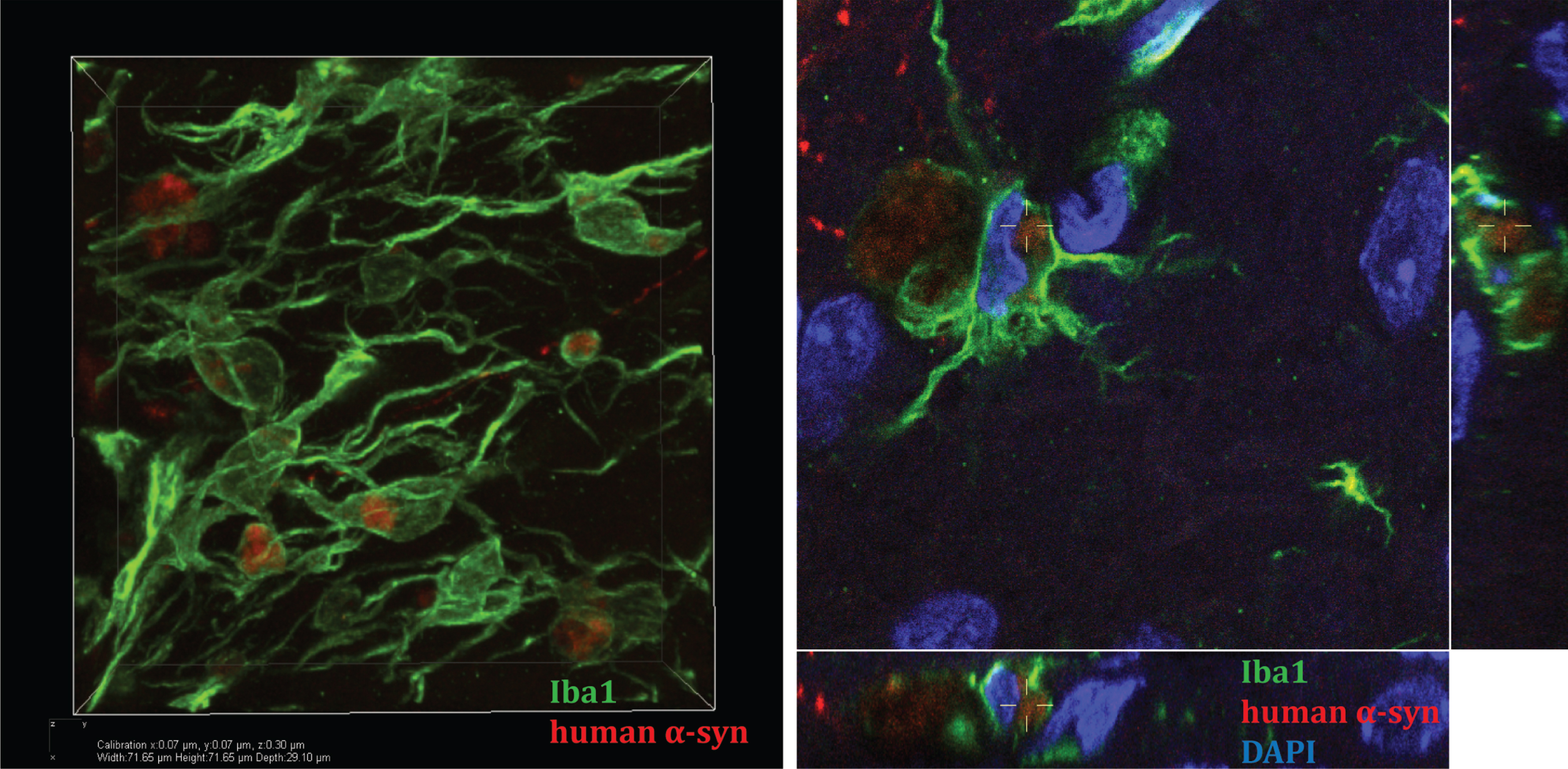 Microglia take up human α-syn in mouse striatum in an in vivo model of α-syn cell-to-cell transfer. A. Confocal three-dimensional reconstruction of microglia (Iba1 positive, green) containing human α-syn (red). B. Reconstructed confocal orthogonal projections are presented as viewed in the x-z (bottom) and y-z(right) planes displays a perinuclear localisation of human α-syn within-microglia (nucleus stainedblue, DAPI).