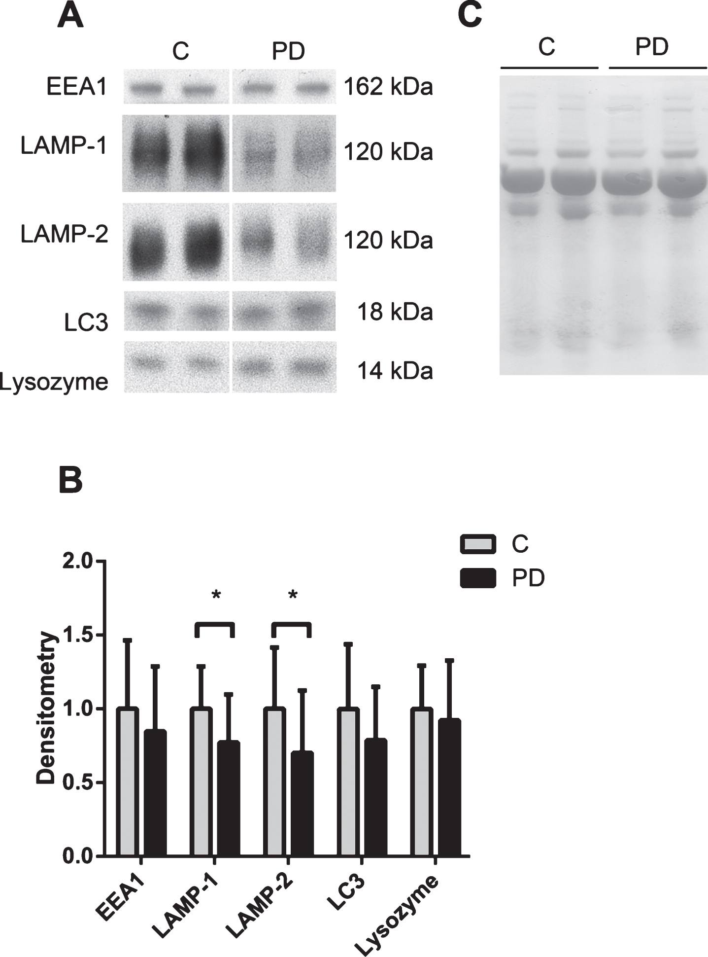 The lysosomal network proteins LAMP-1 and LAMP-2 are downregulated in the CSF of PD patients. A) Representative samples from one Western blot of CSF from controls (C) and Parkinson’s disease (PD) patients analyzed for the lysosomal network proteins EEA1, LAMP-1, LAMP-2, LC3 and lysozyme. B) Mean densitometric quantification of the scanned Western blots from C (n = 18) and PD (n = 18) patients. The protein levels are normalized to a standard CSF sample loaded on each gel. C) Equal sample loading was verified by Ponceau S staining of total protein in each lane on the membranes. The bars represent the mean±SD, *p < 0.05.