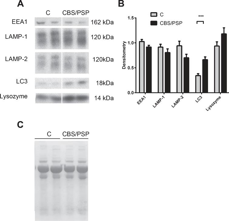 The lysosomal network protein LC3 is upregulated in the CSF of clinically diagnosed 4-repeat tauopathy patients. A) Representative samples from one Western blot of CSF from controls (C) and clinically diagnosed 4-repeat tauopathy patients (CBS/PSP), analyzed for the lysosomal network proteins EEA1, LAMP-1, LAMP-2, LC3 and lysozyme B) Mean densitometric quantification of the scanned Western blots from C (n = 11), clinically diagnosed 4-repeat tauopathy patients (CBS, n = 6 and PSP, n = 5). The protein levels are normalized to a standard CSF sample loaded on each gel. C) Equal sample loading was verified by Ponceau S staining of total protein in each lane on the membranes. The bars represent the mean±SD, ***p < 0.001.