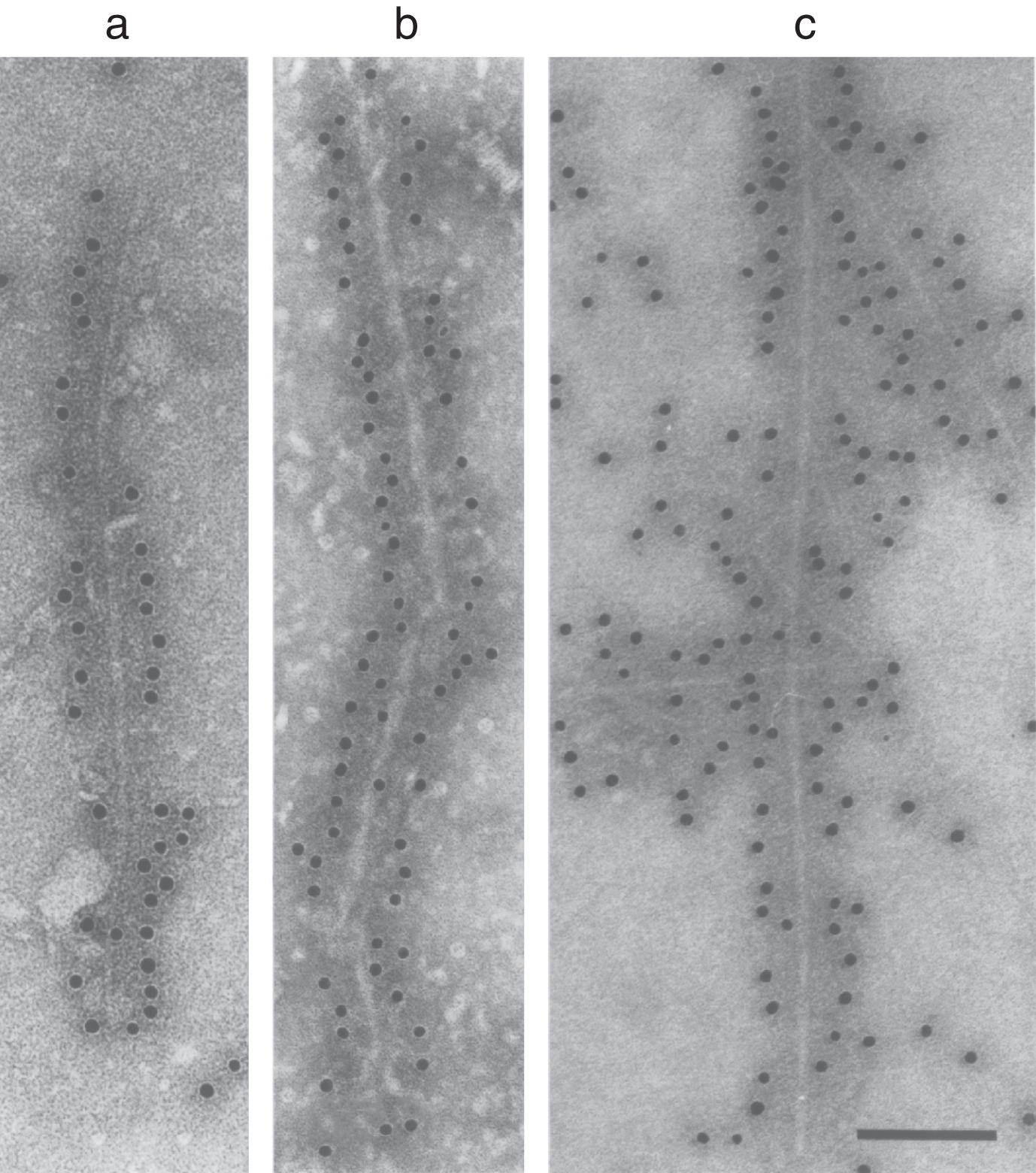 Filaments extracted from the brains of patients with dementia with Lewy bodies (a) and multiple system atrophy (b) or assembled from bacterially expressed human α-synuclein (c) were decorated by an anti-α-synuclein antibody. The gold particles conjugated to the secondary antibody appear as black dots. From Goedert and Spillantini [206].