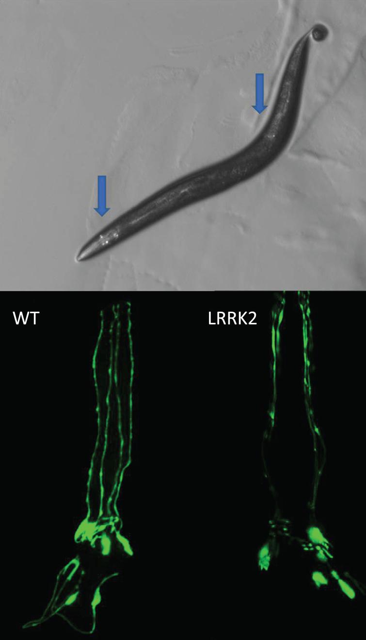 Loss of dopamine neurons. C. elegans hermaphrodites have eight dopamine neurons that can be visualized in live worms by expressing a fluorescent protein such as GFP with a dopamine neuron specific promoter such as dat-1. There are six dopamine neurons in the head and two posterior, as indicated by the blue arrows (top). The progressive loss of dopamine neurons can be monitored throughout the lifespan of the worm. Expression of human mutant LRRK2 with G2019S mutation causes an accelerated loss of dopamine neurons (bottom). Bottom panels show only the head region of the worm with the tip of the nose facing the top of the page.