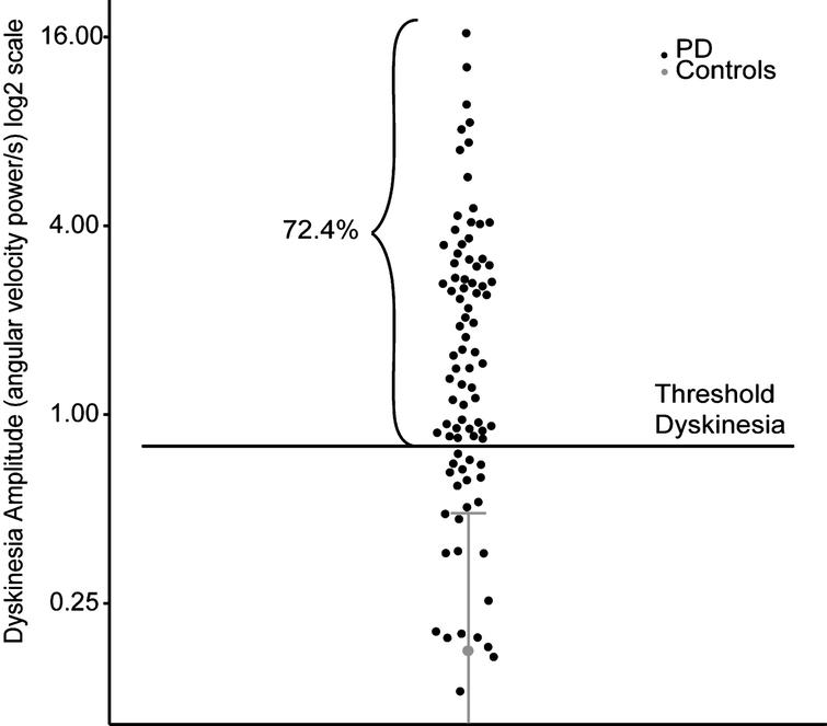 Dyskinesia amplitude of controls and participants with PD. Dyskinesia detection in patients (black) based on the behavior of healthy controls (grey). Mean plus two standard deviations of data from controls are illustrated in gray. Individual data points from patients are illustrated in black.
