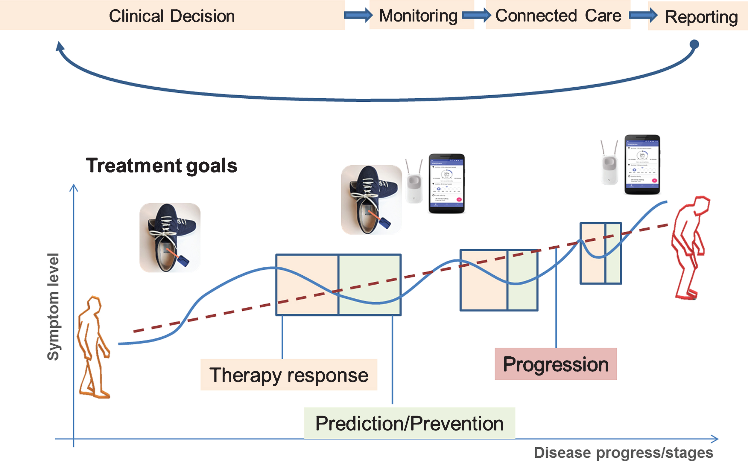 Digital Health Pathway for Gait and Falls in PD. The patient here is monitored using a combination of wearable sensors equipped with gyroscopes and accelerometers that are incorporated into the subject’s own shoes, or into a falls detector (worn as a necklace around the neck) and a smartphone. Two typical real-life care scenarios are illustrated here. Therapy response: the current state of the individual patient indicates a worsening at the symptom levels that necessitates an adaptation of the therapy (e.g., increase or reduce pharmacological treatment, initiate or intensify physiotherapy, etc.). Prediction/prevention: the symptom level is in an optimal state, and there is no need to adjust the therapy, but now the goal is to predict new worsening or development of foreseeable symptoms along natural disease progression (e.g., development of postural instability, increased risk of falling, etc.). Additionally, the overall disease trajectory expressing the theoretical progression rate of the individual patient also taking into account intercurrent events (infections, co-morbidities, operations, etc.) can be deducted from longitudinal and individualized target parameter assessment over the disease course.