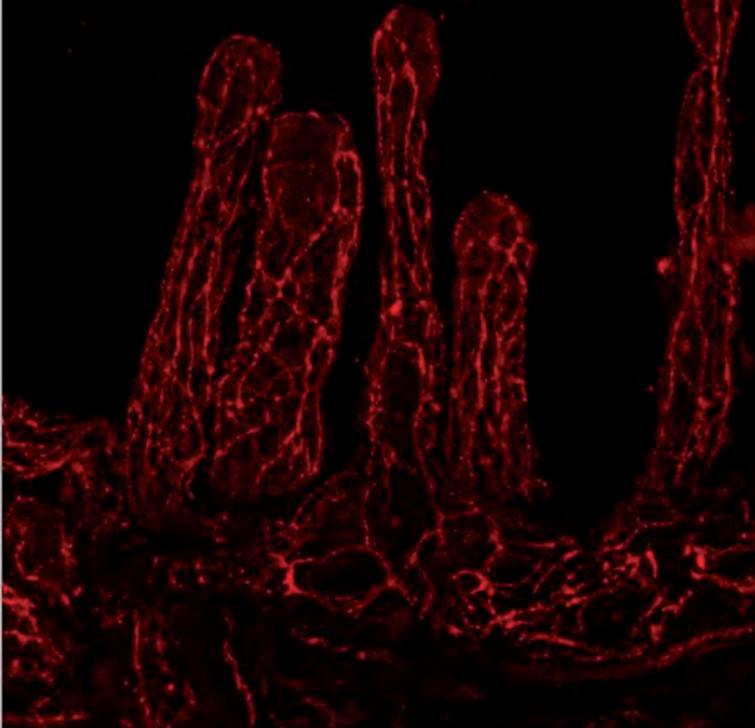 Subepithelial enteric neurons visualized with PGP9.5 immunostaining from human small intestine. The epithelial layer was detached from the underlying lamina propria by EDTA treatment [51] and visualized as described [25].