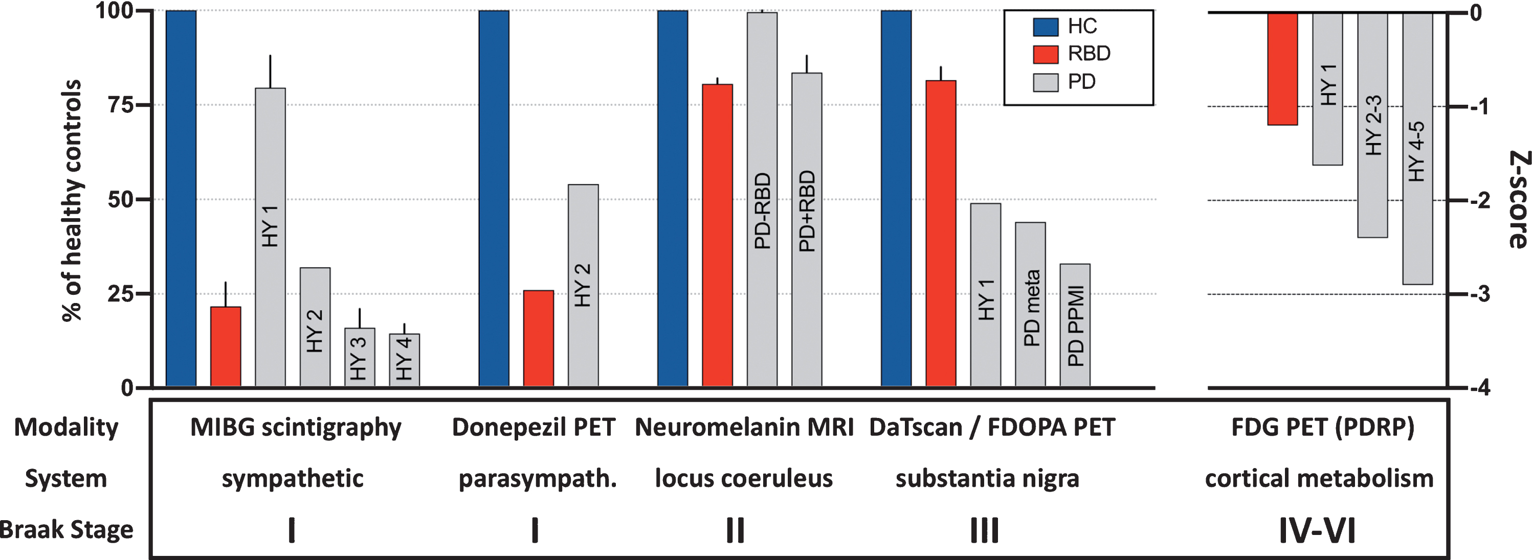 Summary of imaging modalities used to measure relevant neuronal systems. The healthy control mean (blue) was set to 100% in each study, and the percentage reduction in the patient groups calculated. In cases with more than one study, the standard deviation is depicted by whiskers. Cardiac sympathetic innervation was measured with 123I-MIBG scintigraphy; intestinal cholinergic (parasympathetic) innervation with 11C-donepezil PET; integrity of pigmented locus coeruleus neurons with neuromelanin-sensitive MRI; nigrostriatal dopaminergic synaptic function with 123I-FP-CIT SPECT or 18F-DOPA PET; cortical glucose metabolism with 18F-FDG and principal component analysis to quantify the PD related network (PDRP) z-score. The corresponding Braak stages are shown in the bottom row. Patients with idiopathic RBD (red) show marked loss of autonomic and locus coeruleus imaging parameters, but only minor dopaminergic terminal loss and only slight perturbation of cortical metabolism. The opposite pattern is seen for H&Y stage I-II PD patients. Concerning annotations to PD data: “HY” shows data from different H&Y stage data sets; “PD meta” shows the mean % reduction in PD patients’ DaTscan putamen binding from a metaanalysis [31], and “PD PPMI” the % putaminal reduction seen in early PD patients from the PPMI data set [35]. [Note that except for PDRP z-scores, the imaging parameters approximate loss of specific binding, i.e. heart/mediastinum ratio – 1 for MIBG; SUV – 1 for donepezil; locus coeruleus/pons – 1 for neuromelanin MRI; putamen/occipital cortex – 1 for FP-CIT & FDOPA. For didactic purposes the PDRP z-scores are listed as negative in this figure in contrast to common practice. See main text for study references.]
