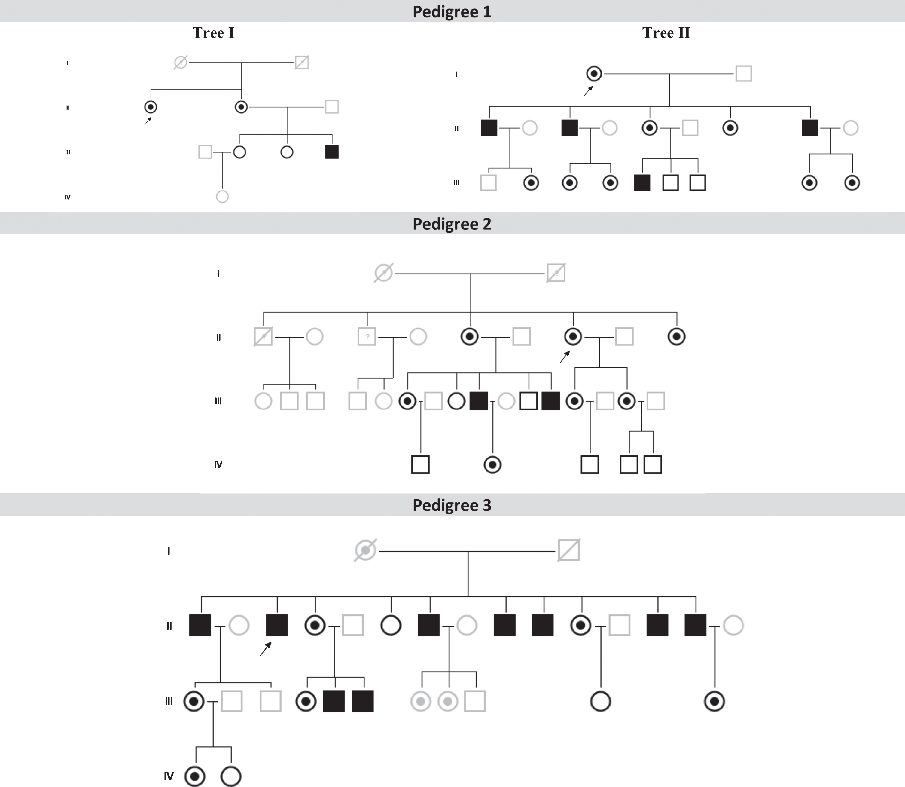 Family pedigrees from the three patients with Parkinson’s disease patients and Fabry disease (FD+PD+) (p. F113L mutation) and their relatives with or without FD. Index FD patients are marked with a black arrow (in Pedigree 1, individuals II-1 from Tree I and I-1 from Tree II are the same index patient). Patients with FD and PD: P1 (Pedigree 1, tree I, II-2); Patient 2 (Pedigree 2, III-9); Patient 3 (Pedigree 3, II-1). Dark symbols represent FD patients. White symbols represent relatives without FD. Grey symbols represent untested individuals.