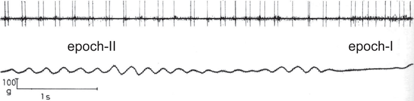 Abnormal motor unit firing pattern in a patient. A motor unit from the first dorsal interosseous muscle was recorded when the patient was trying to exert a constant force with his finger against a strain gauge. Rhythmical doublets or doublets interchanged with single discharges characterize the interval of overt tremor (epoch-II). Note that the firing pattern is more regular and the rate (around 10–12 spikes/s) does not change appreciably when the tremor subsides (epoch-I; from [43]; Fig. 4, with kind permission).