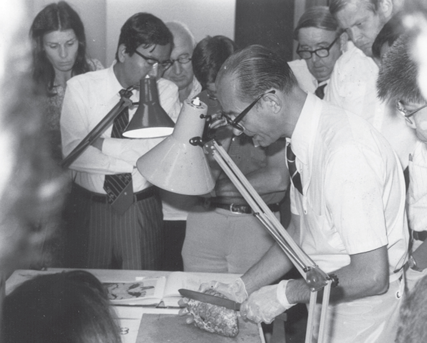 Oleh Hornykiewicz at an NIH sponsored Brain Dissection Seminar in Vienna in 1979. (courtesy Prof. G. Sperk, Innsbruck, Austria).