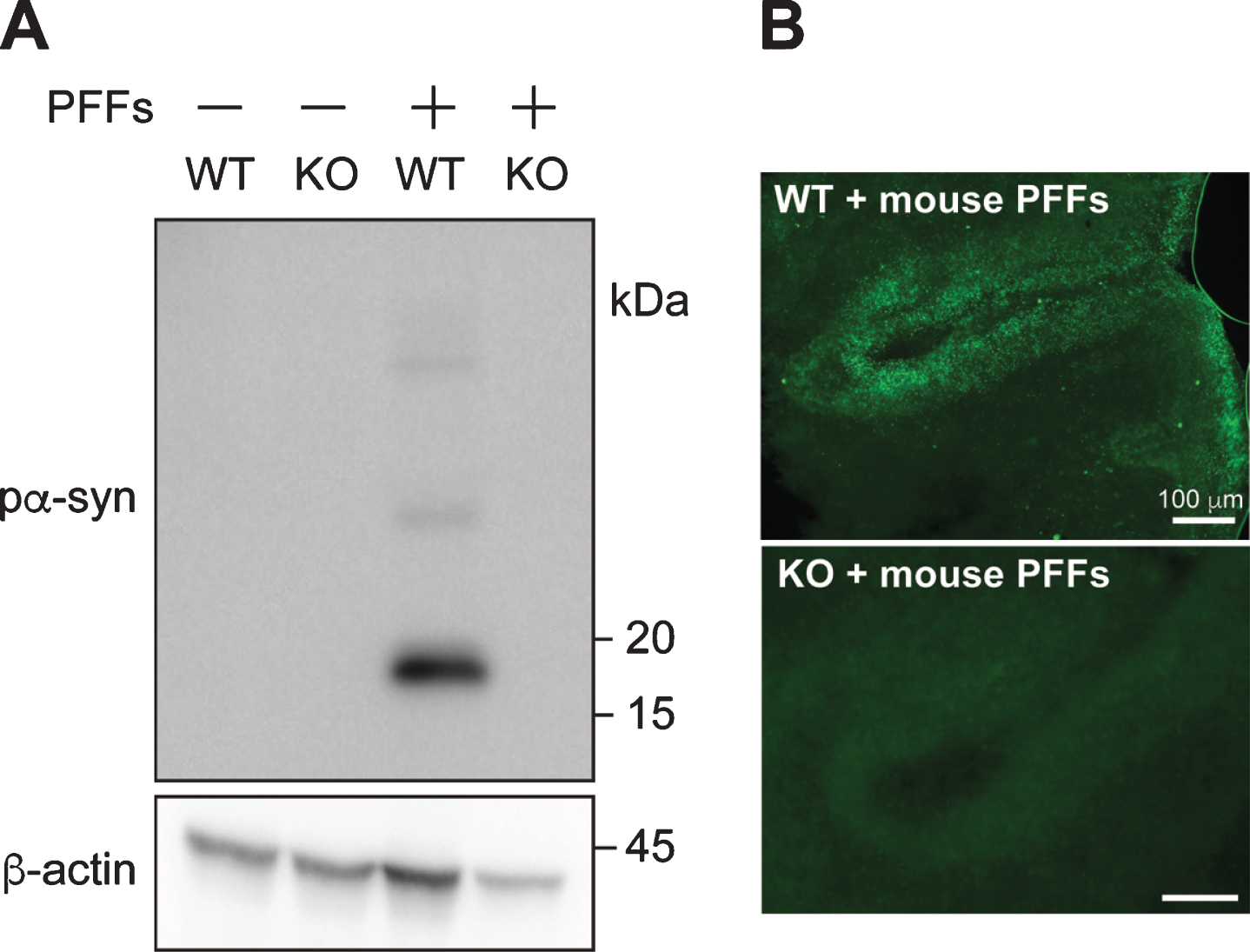 PFF-induced pα-syn is derived from endogenous α-syn. A) Cerebellar slices from wild-type (WT) or α-syn knock-out (KO) mice were treated with or without PFFs for 4 weeks. The presence of pα-syn and β-actin were detected by immunoblot analyses. B) Immunofluorescence staining of pα-syn in wild-type (WT) or α-syn knock-out (KO) cerebellar slices treated with mouse PFFs as indicated. Scale bar represents 100 μm.