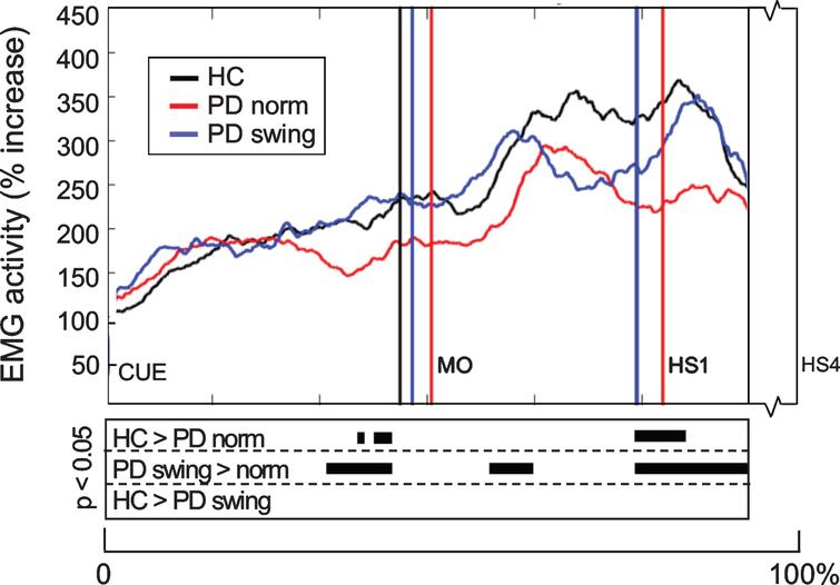 Rectus Femoris EMG activity of the leading limb during gait initiation. Group averages of EMG activity, which are time-normalized for the interval between the beep (CUE) and fourth heel strike (HS4), are presented for the Rectus Femoris of the leading limb. The muscle activity is displayed as percentage increase relative to the activity when standing still, given for the healthy controls (HC, black), Parkinson patients starting according to normal baseline instruction (PD norm, red) and Parkinson patients starting with enhanced arm swing (PD swing, blue). Vertical lines mark the mean group latencies of movement onset (MO) and first heel strike (HS1). Beneath the activity curves, black squares display the time points with significant differences between conditions (corrected p < 0.05, Mann-Whitney U for independent data and Wilcoxon Signed Rank for paired data).