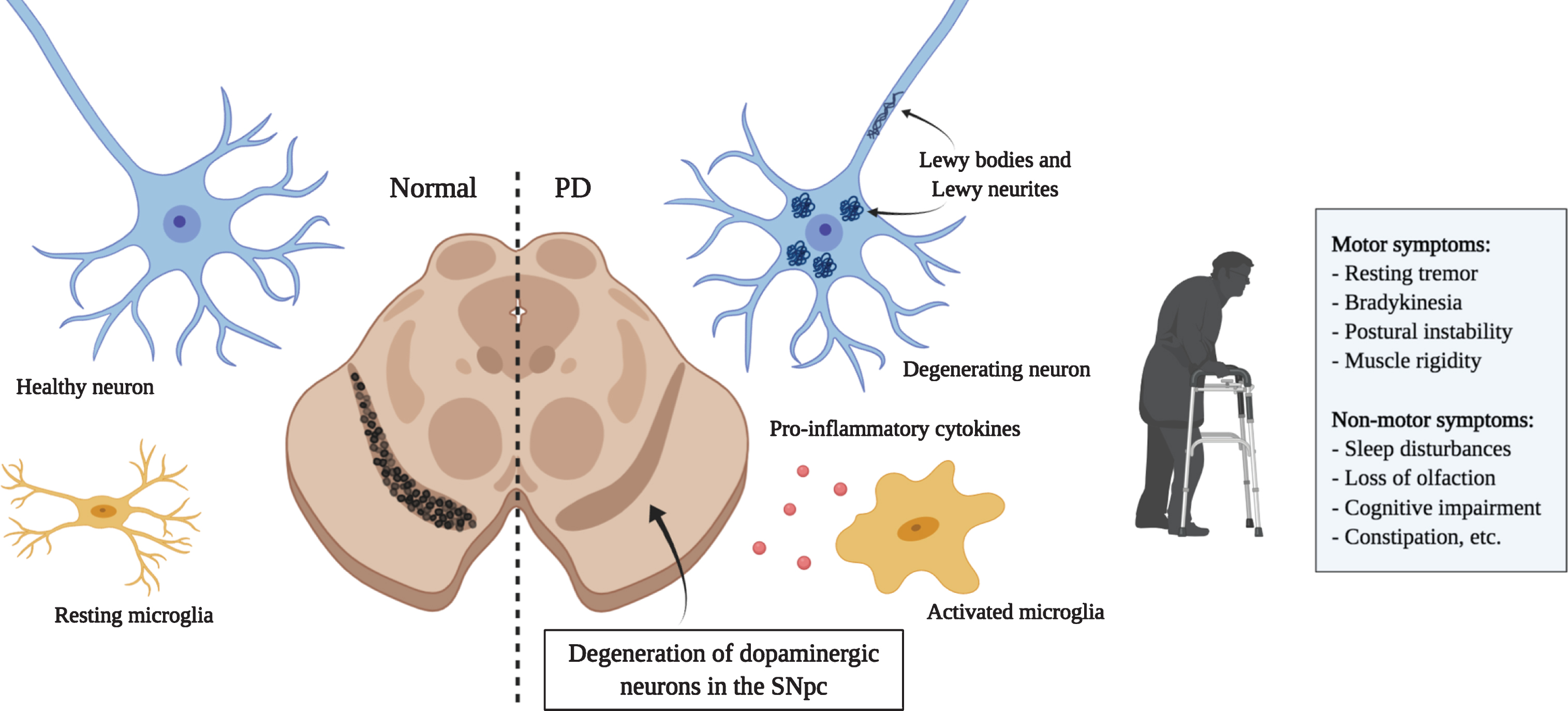 Principal hallmarks of Parkinson’s disease. Parkinson’s disease is characterized by the loss of dopaminergic neurons in the substantia nigra. Affected neurons present insoluble aggregates in their cytoplasm and neurites called Lewy bodies and Lewy neurites, respectively. These inclusions are predominantly composed of the protein alpha-synuclein. Activated microglia releasing pro-inflammatory cytokines are also present and promote an inflammatory environment possibly contributing to neuronal loss. Dopaminergic neuron degeneration leads to the classical motor symptoms. It is hypothesized that the affection of non-dopaminergic neurons in other brain regions would be responsible for the various non-motor symptoms that also greatly affect quality of life. (Created with BioRender)