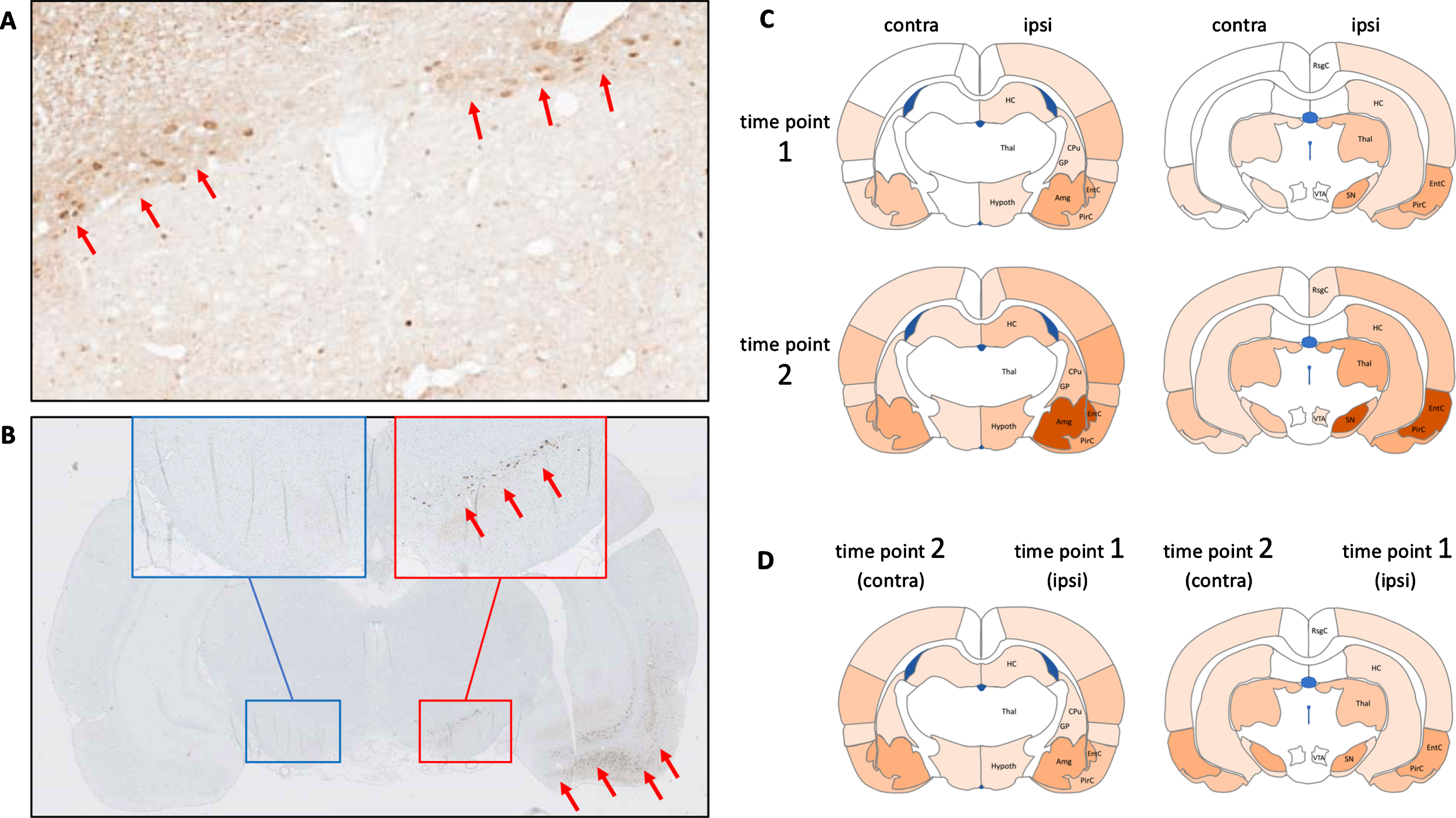 A) The DMV nuclei in rats show symmetric deposits of pathological, hyperphosphorylated α-synuclein inclusions following injection of α-synuclein seeds in the duodenum. B) Following unilateral injection of α-synuclein fibrils into the amygdala, α-synuclein inclusions are seen in ipsilateral limbic and cortical structures, with early involvement of the ipsilateral substantia nigra (red insert). No contralateral pathology is seen at this early timepoint. These wild-type rats were both sacrificed three months post-injection. C) Schematic representation of published data from injection of α-synuclein seeds unilaterally into a single CNS location [56, 57, 59]. Markedly asymmetric α-synuclein pathology is evident at the early time point 1. At the later time point 2, progressive accumulation of α-synuclein is seen in nearly all affected regions, but the asymmetry persists. D) The distribution of α-synuclein pathology in the ipsilateral hemisphere at time point 1 is very similar to the α-synuclein distribution in the contralateral hemisphere at time point 2. This suggests that the α-synuclein pathology in the contralateral hemisphere is, in part, promoted by commissural homolog-to-homolog connections from the ipsilateral hemisphere.