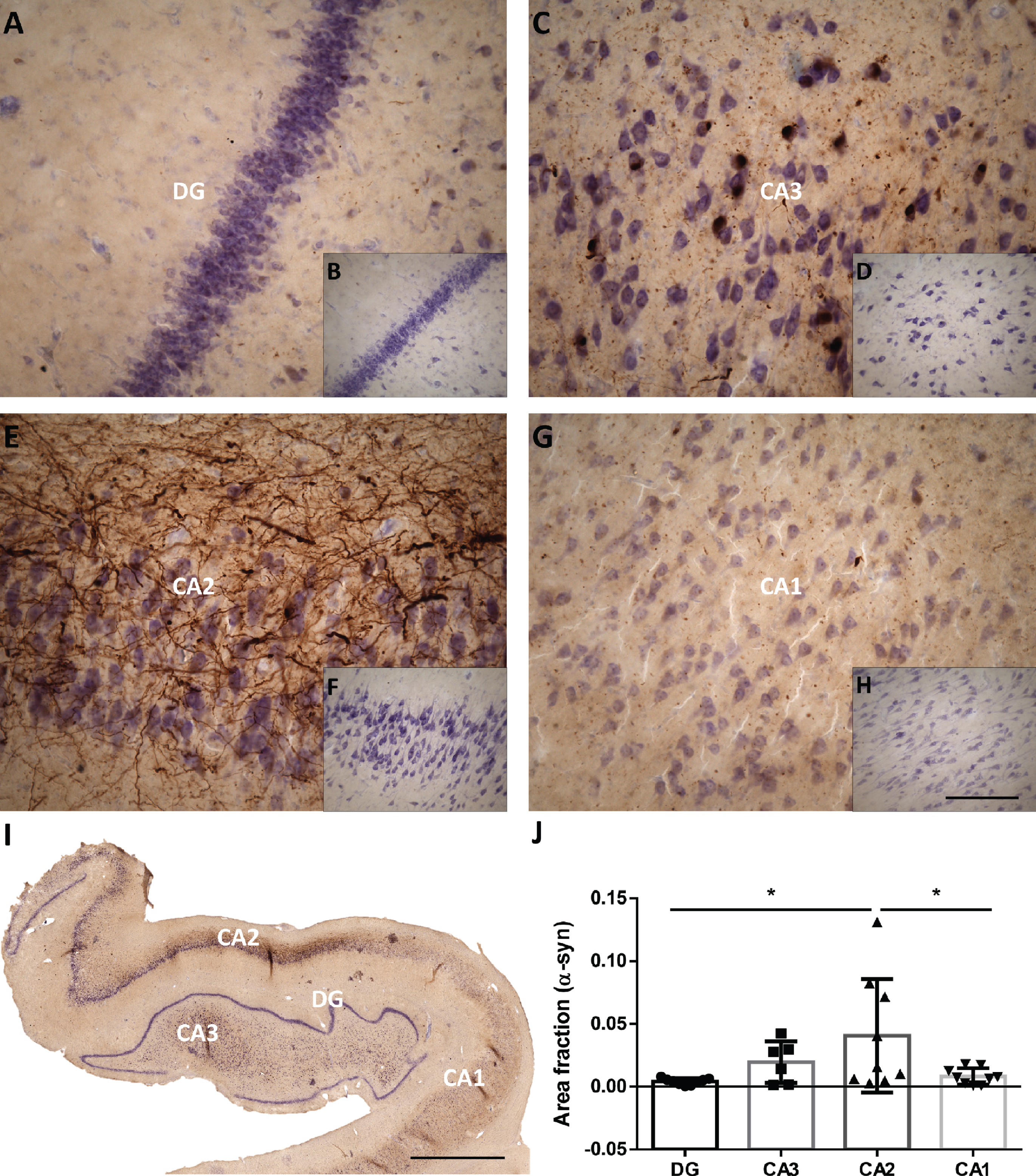 Mosaic reconstruction (I) and picture of the DG, CA3, CA2 and CA1 of the human hippocampus with PD (A, C, E, G respectively) and without PD (B, D, F, G respectively) immunohistochemistry stained for α-synuclein. The mean±SD of the area fraction occupied by α-synuclein in the different regions of the hippocampus in the total hippocampus of PD cases (J). Scale bars 90μm (A, C, E, G), 250μm (B, D, F, H) and 2000μm (I).