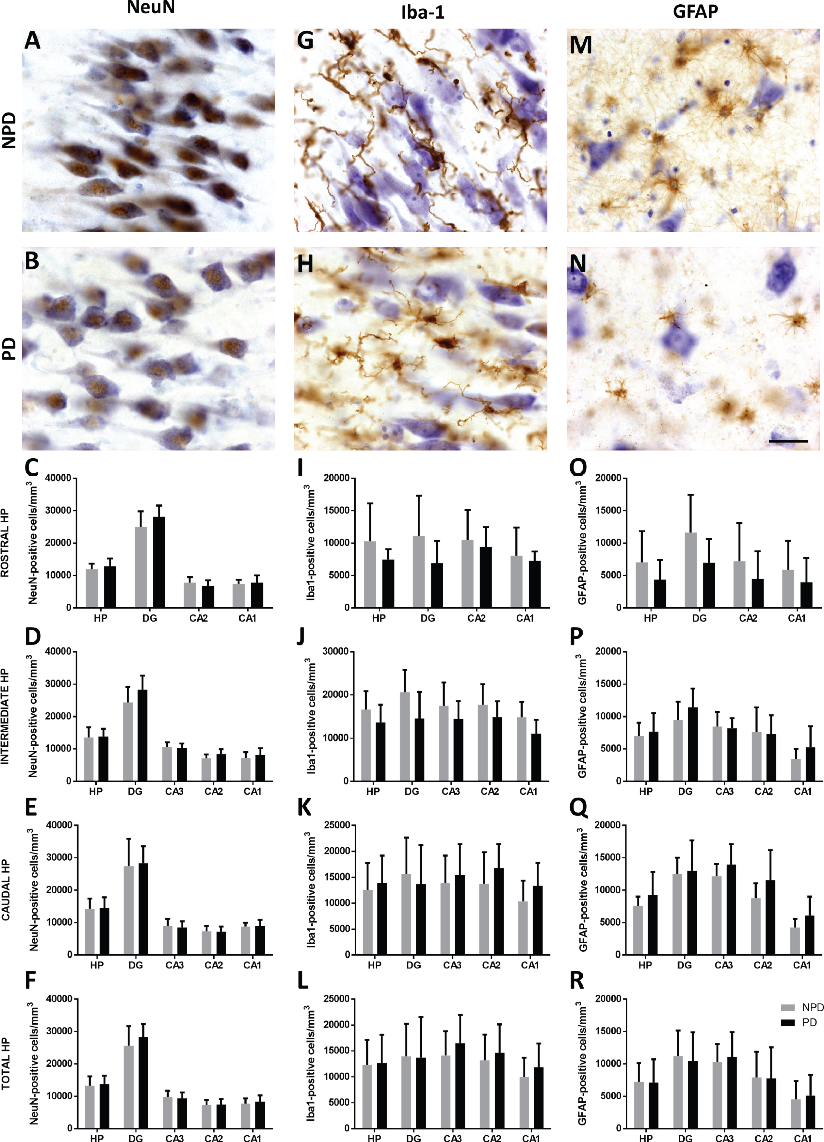 Coronal sections of the human hippocampus immunohistochemically stained for NeuN (A-B), Iba-1 (G-H) and GFAP (M-N). The mean±SD of NeuN (C-F)-, Iba-1 (I-L)- and GFAP (O-R)-positive cell density of hippocampal regions in the rostral, intermediate, caudal and total hippocampus. Scale bar 25μm (A-N).