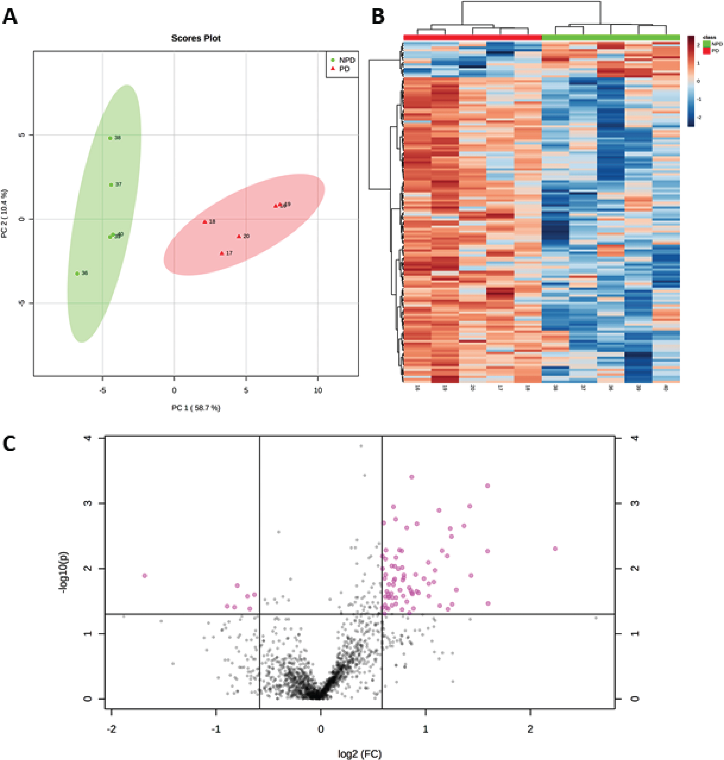 A) PCA plot, using principal components 1 and 2, shows that the NPD cases (green dots) and PD cases (red triangles) are distributed in two well-separated groups based on significantly altered proteins in PD (p < 0.05). B) Heat map of proteins with levels varying significantly (p < 0.05) across PD and NPD cases and used for sample clustering. C) Volcano plot showing 7 downregulated and 76 upregulated proteins (pink points) with fold change≥1.5 (or≤0.66) and p < 0.05.