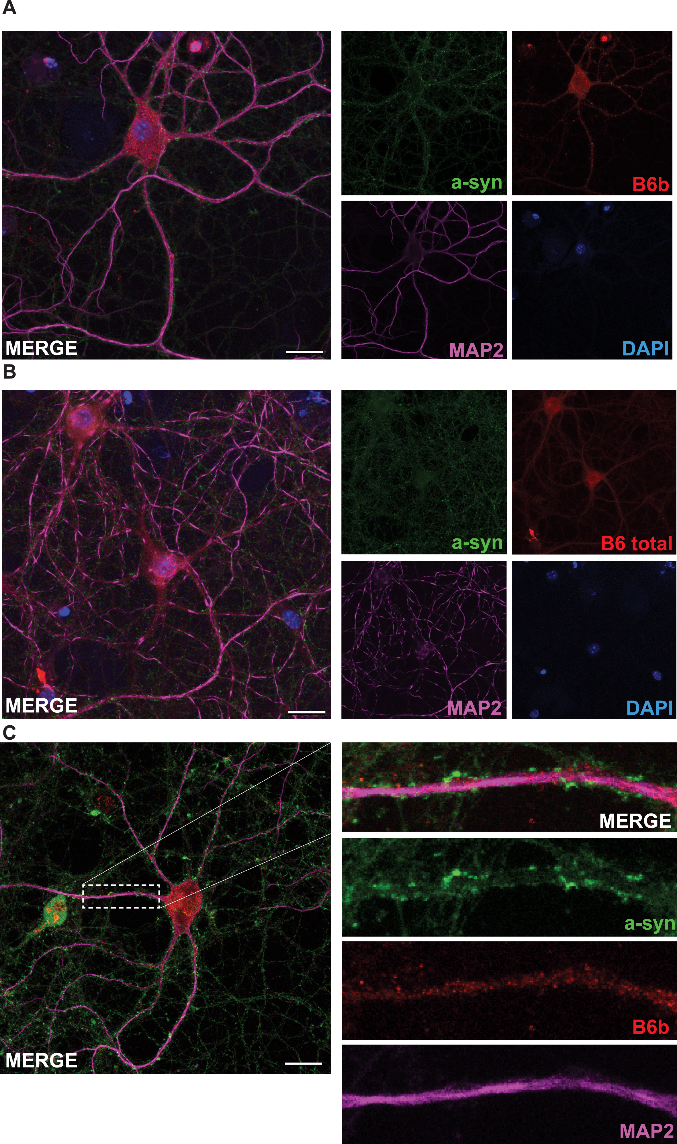 DNAJB6b and total DNAJB6 are expressed in primary neurons. Fixed primary mouse neurons stained with anti-DNAJB6b (A) or anti-total DNAJB6 (B) as well as anti-MAP2, anti-α-syn and dapi and fluorescently labeled anti rabbit Alexa 488 and anti sheep Cy5 antibodies. C) Depicts a close up picture of a dendrite stained with antibodies against α-syn, MAP2, and DNAJB6b as well as secondary fluorescently labeled anti-rabbit and anti-sheep antibodies.