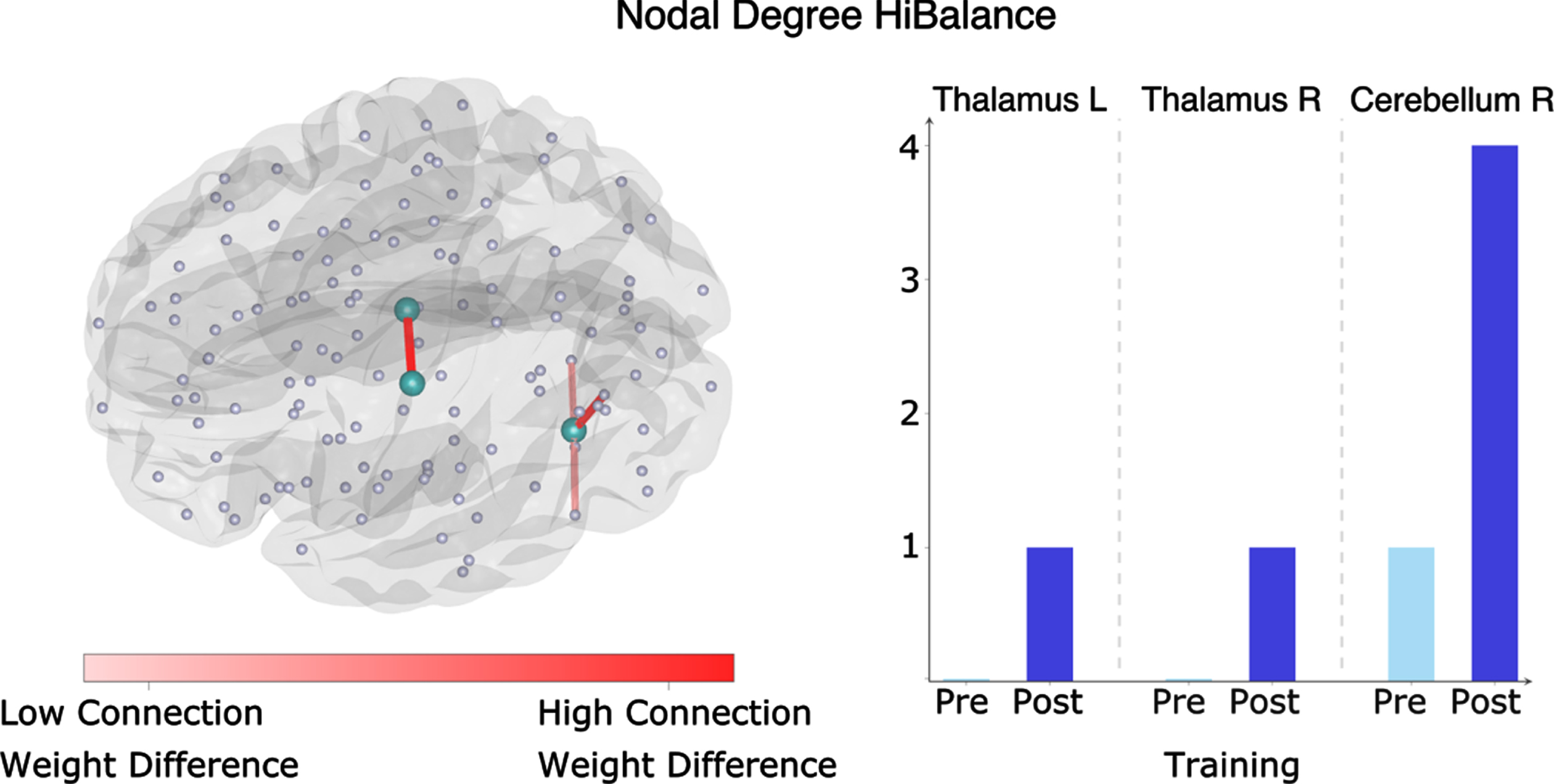 Nodal degree in the HiBalance cohort. Left side: changes in degree significant in three nodes (turquoise). In red are the connections shown that differed between before and after the HiBalance training program. Right side: diagram showing number of connections of the significant nodes before and after the training program. R, right; L, left.