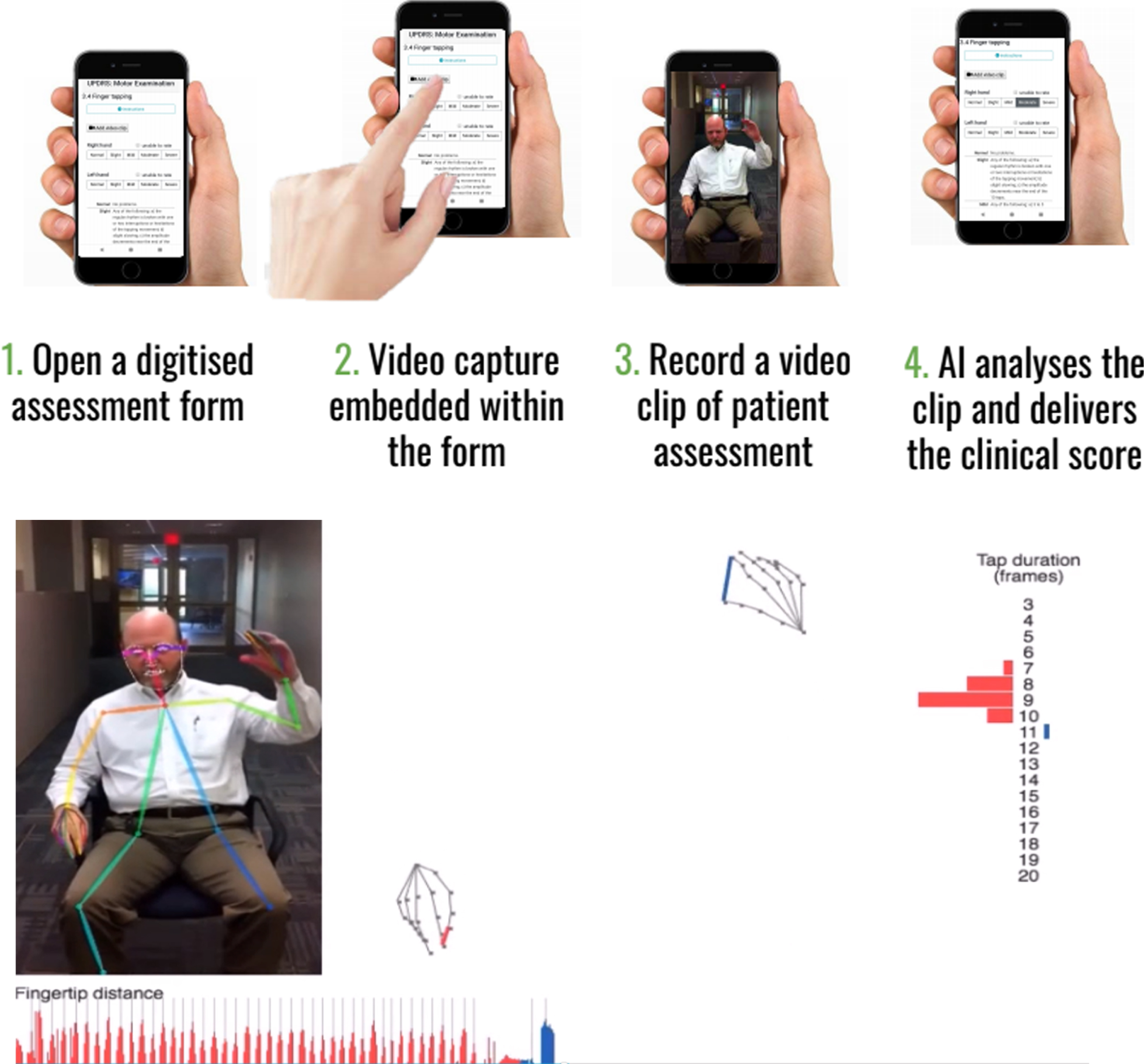 Example of Kelvin, a platform that allows the user to record 2D videos of patients with PD on any accessible device, and an inbuilt AI system will analyse the clip and denote scores according to items of the UPDRS. Reproduced with permission.