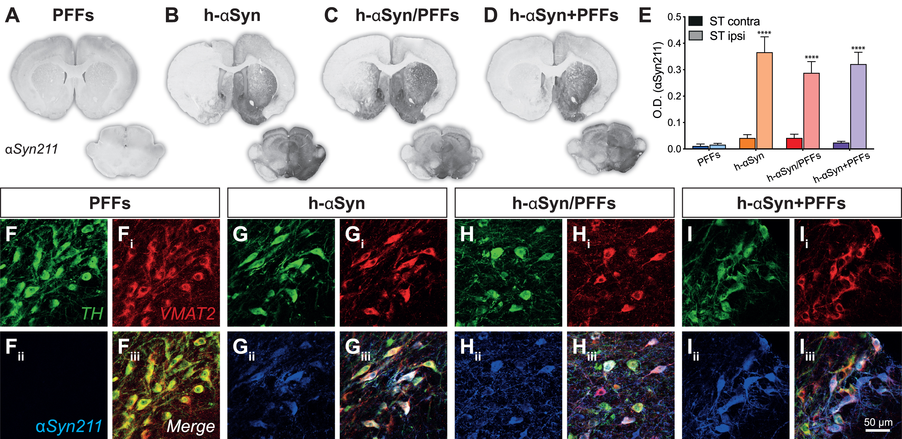 AAV-vector overexpression. A-D) Representative midbrain and striatal sections for each group stained for human αSyn (αSyn211). E) Densitometric analysis comparing human αSyn211 staining intensity between contralateral and ipsilateral right striatum. F-Iiii) Triple immunofluorescence demonstrating colocalization between TH, VMAT2, and αSyn211 antibodies in SNpc. PFFs, preformed fibrils; h-αSyn, human alpha-synuclein; contra, contralateral; ipsi, ipsilateral; O.D., optical density. Data are expressed as mean ± SEM. (****p < 0.0001).