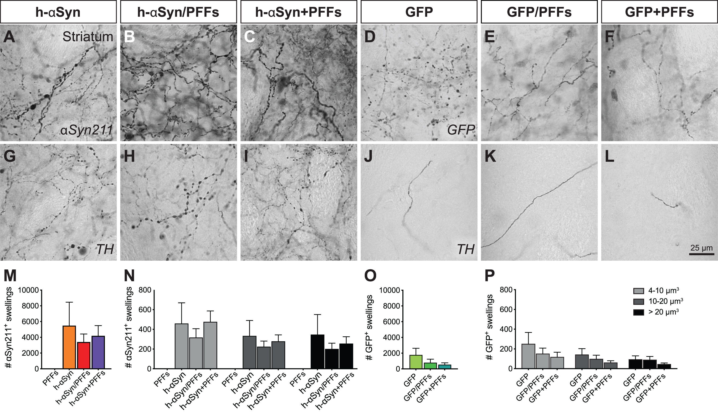 Axonal pathology in the ipsilateral striatum. Immunohistochemical analysis to investigate the presence of axonal pathology using antibodies for αSyn211 (A-C), GFP (D-F), and TH (G-L). Quantification of αSyn211+ (M,N) and GFP+ swellings (O,P) in the ipsilateral striatum. The quantified swellings were counted by total number (M,O) and volume size (N,P). PFFs, preformed fibrils; h-αSyn, human alpha-synuclein; GFP, green fluorescent protein. Data are expressed as mean ± SEM.