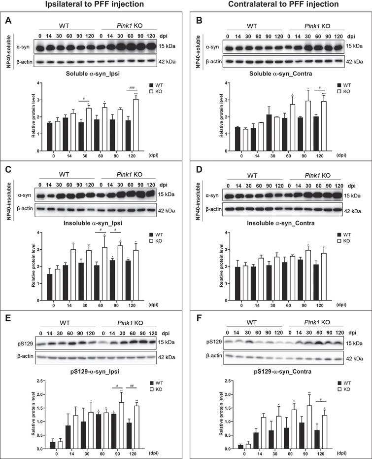 Increased levels of soluble and insoluble α-syn in Pink1 KO mice after PFF injection. Representative immunoblots of NP40-soluble α-syn levels in both brain hemispheres after PFF injection and its quantification analysis normalized to β-actin in the ipsilateral brain (A) and contralateral brain (B). Representative immunoblots of NP40-insoluble α-syn levels in the ipsilateral brain (C) and contralateral brain (D). pS129-α-syn levels in both brain hemispheres and its quantification analysis in the ipsilateral brain (E) and contralateral brain (F). Statistical analysis was determined using one-way ANOVA followed by post-hoc Sidak’s test and two-way ANOVA followed by post-hoc Turkey’s test and for multiple group comparisons. Ipsi, ipsilateral; Contra, contralateral; otherwise are same as previous figures.