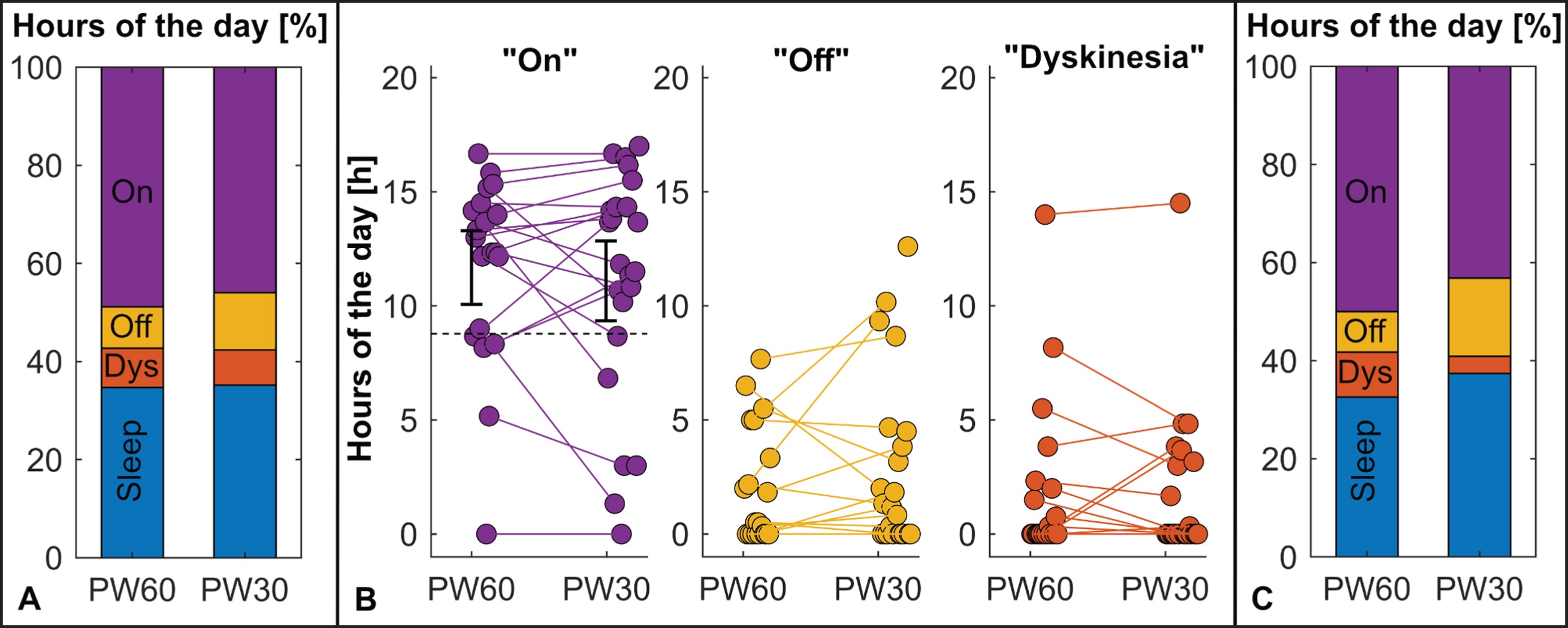 Motor Diary Outcomes. A) There were no differences in motor states as on the group level between treatment conditions. B) On the subject level, individual differences between the treatment conditions were observed. Relation of the respective 90% -CI and the non-inferiority margin (dashed line) for the “On” state, the primary outcome parameter, is indicated in the respective subfigure. C) Patients preferring 30 μs (N = 9) seemed to experience more dyskinesia in their non-preferred 60 μs setting (PW60), whereas patients preferring 60 μs (N = 9) tended to have more Off-time in their non-preferred 30 μs setting (PW30). PW30, trial condition with 30 μs; PW60, trial condition with 60 μs.