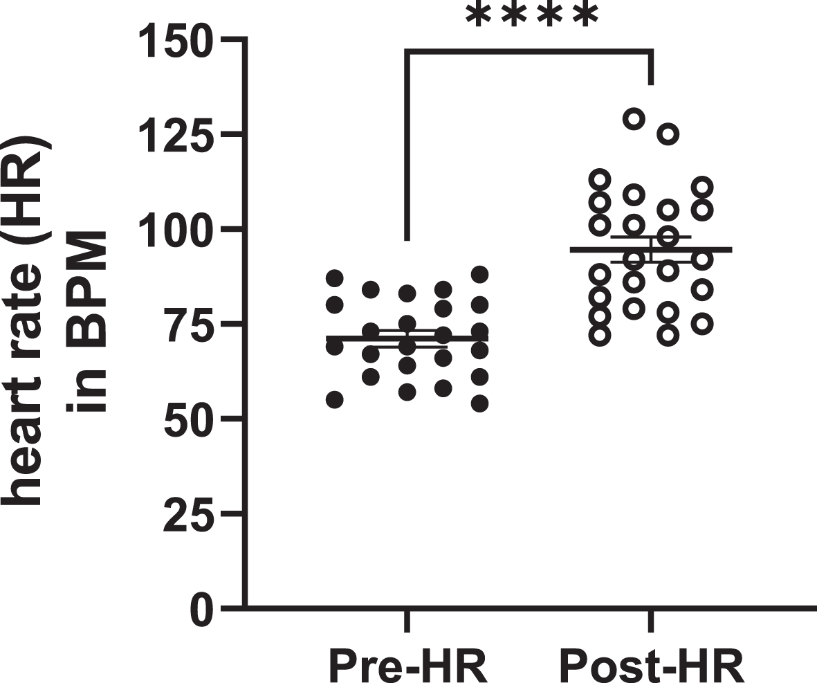 Non-contact boxing-training exercise regimen impact on HR in early-stage human PD subjects. Mean pre-exercise (Pre-Ex) baseline HR in early-stage PD patients immediately prior to participation in the aerobic exercise regimen was 71.1±10.4 beats per min (BPM) and 94.6±16.2 BPM in the post-exercise (Post-Ex) condition resulting in ∼33% increase in HR [t(23) = 6.71, p < 0.0001].