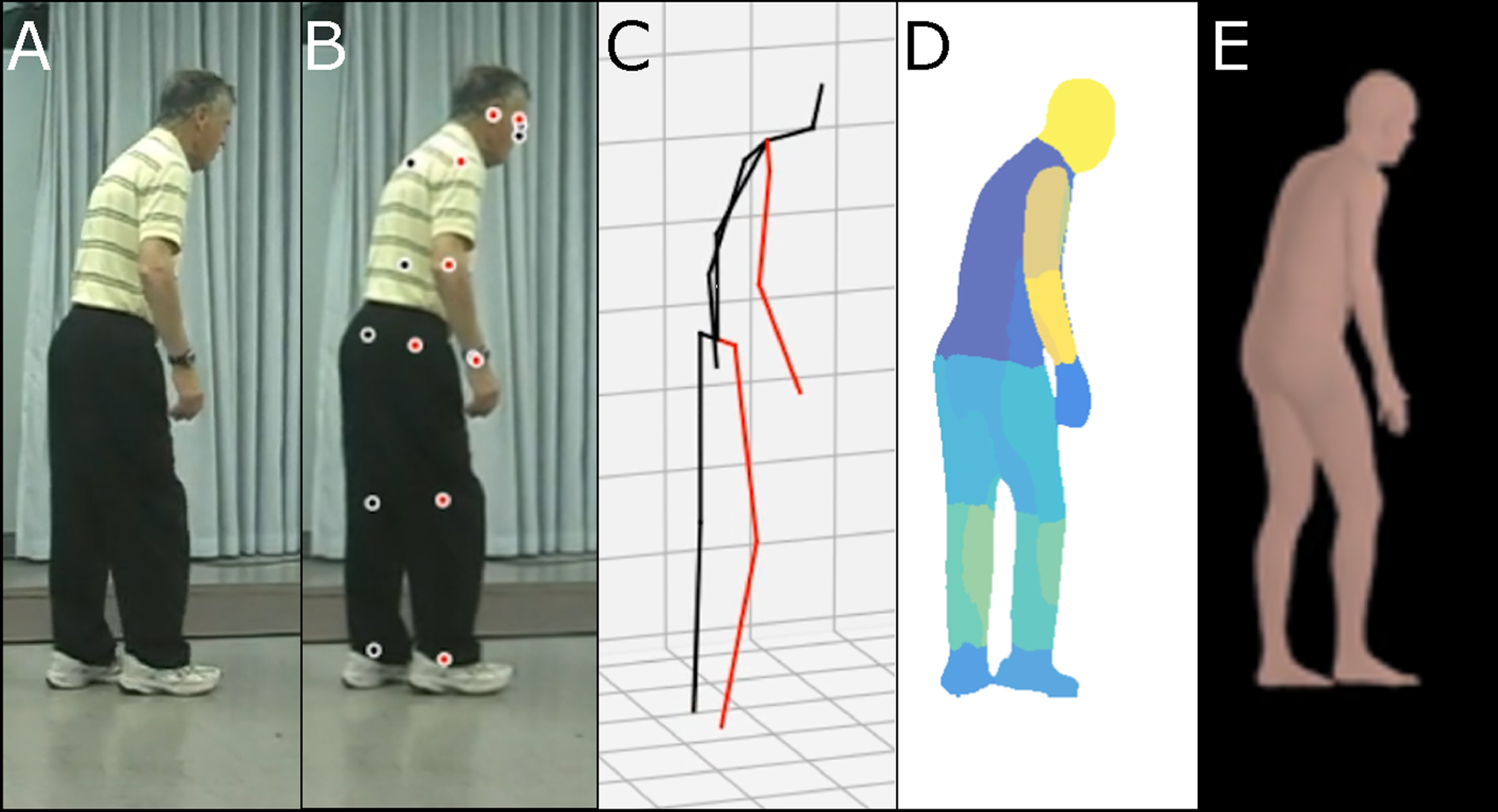 Illustration of synthetic human body modeling methods. A) Raw video image from open-source examples of Parkinson’s disease characterization through postural assessment. This video was obtained with permission from publisher Wiley [57]. B) Keypoints overlaid on video images. C) Skeletal representation. D) Body-parts-based representation. E) 3D volumetric representation.