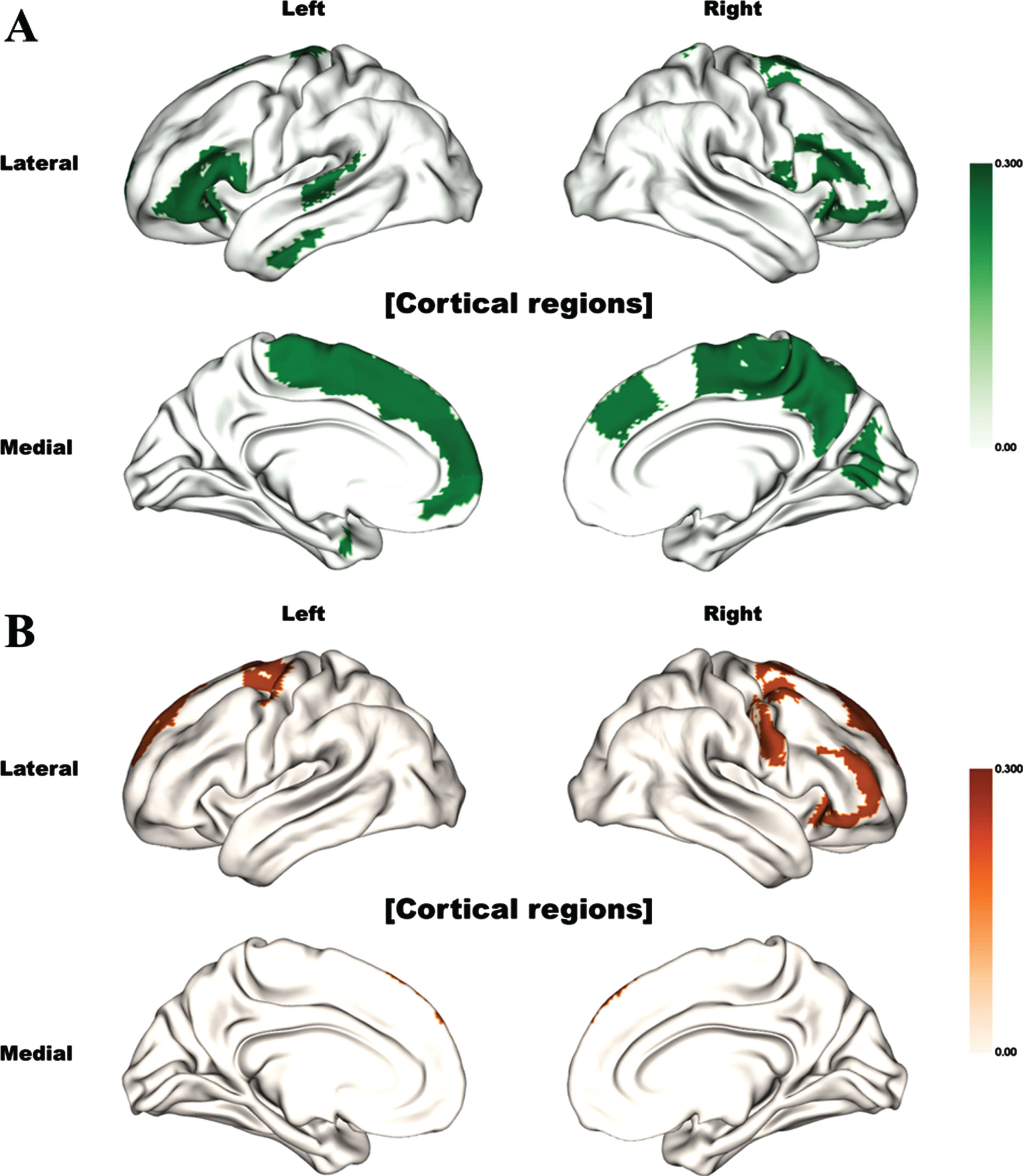 Brain regions significantly correlated with motor reserve estimate (Bonferroni corrected). The color indicates the correlation (rho) value. Significant correlations between motor reserve estimates and (A) fractional anisotropy values and (B) degree centrality values are shown.