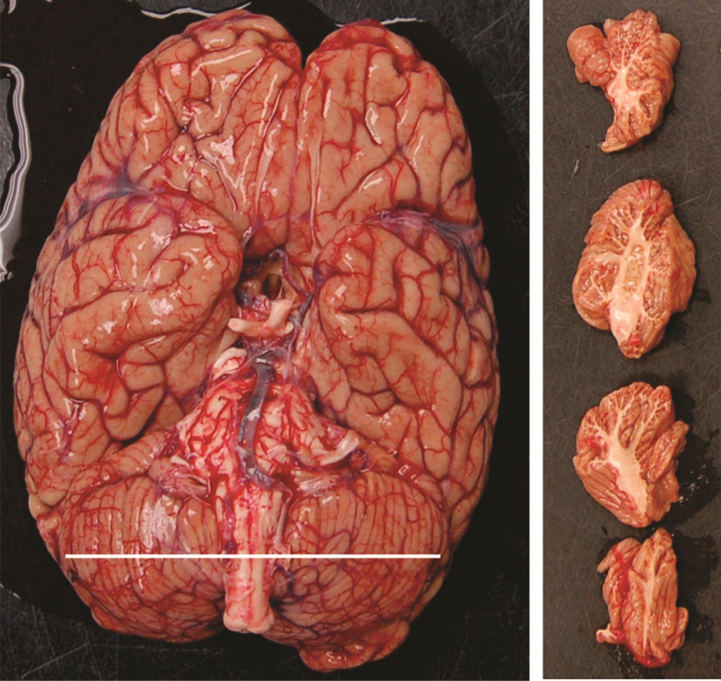 Ventral view of a brain demonstrating the cerebellum width and parasagittal slices of the cerebellum.