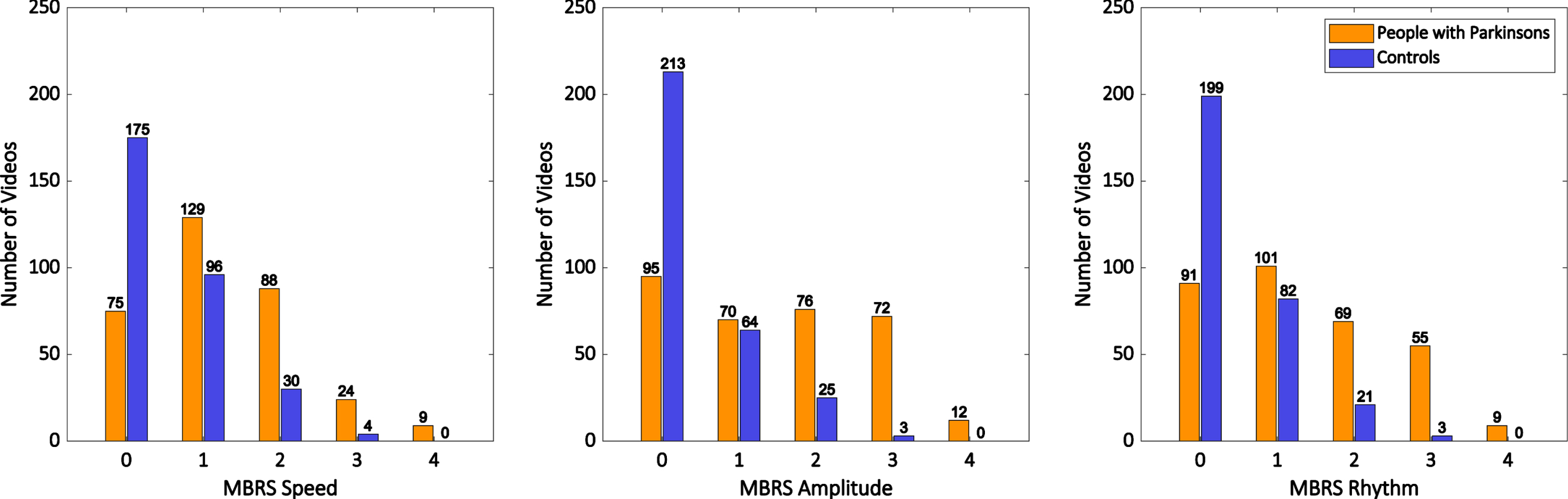 Histograms showing the distribution of MBRS finger tapping scores for all ratings of the hands of people with Parkinson’s disease (orange bars) and control participants (blue bars).