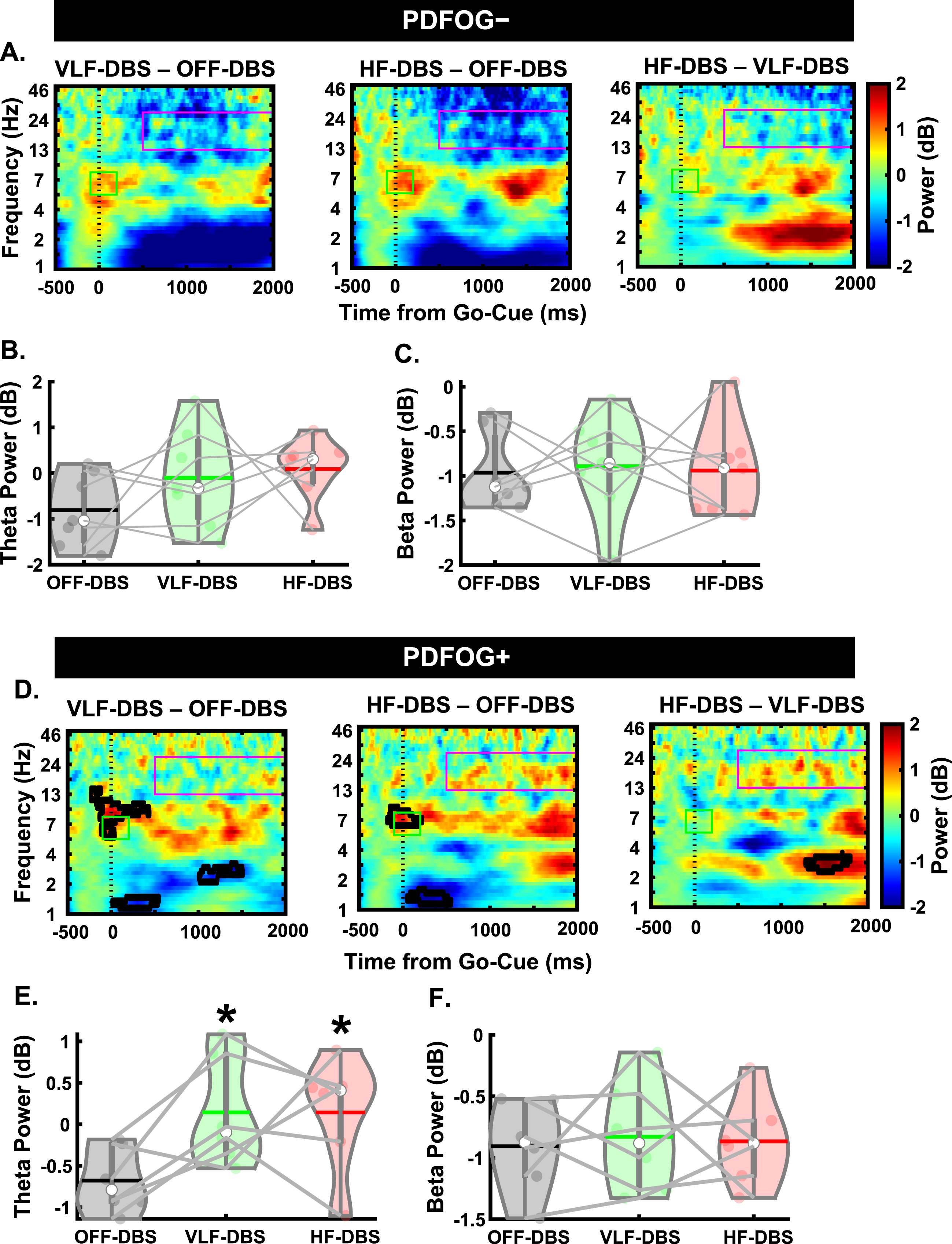 Different responses to STN-DBS between PDFOG–and PDFOG + subgroups during the lower-limb pedaling task. A) Time-frequency plots demonstrating differences between STN very low-frequency (VLF)-DBS and OFF-DBS (left), high-frequency (HF)-DBS and OFF-DBS (middle), and HF-DBS and VLF-DBS (right) for the PDFOG–subgroup. B, C) No effects of stimulation are observed in the theta and beta frequency bands for PDFOG–. D) Time-frequency plots demonstrating differences between STN VLF-DBS and OFF-DBS (left), HF-DBS and OFF-DBS (middle), and HF-DBS and VLF-DBS (right) for the PDFOG + subgroup. E) Both VLF- and HF-DBS result in increased theta-power during the pedaling task for the PDFOG + subgroup. F) No effect of STN-DBS is observed in the beta-band for the PDFOG + subgroup. *p < 0.05 vs. OFF. In violin plots, horizontal lines and white circles represent the mean and median values, respectively.