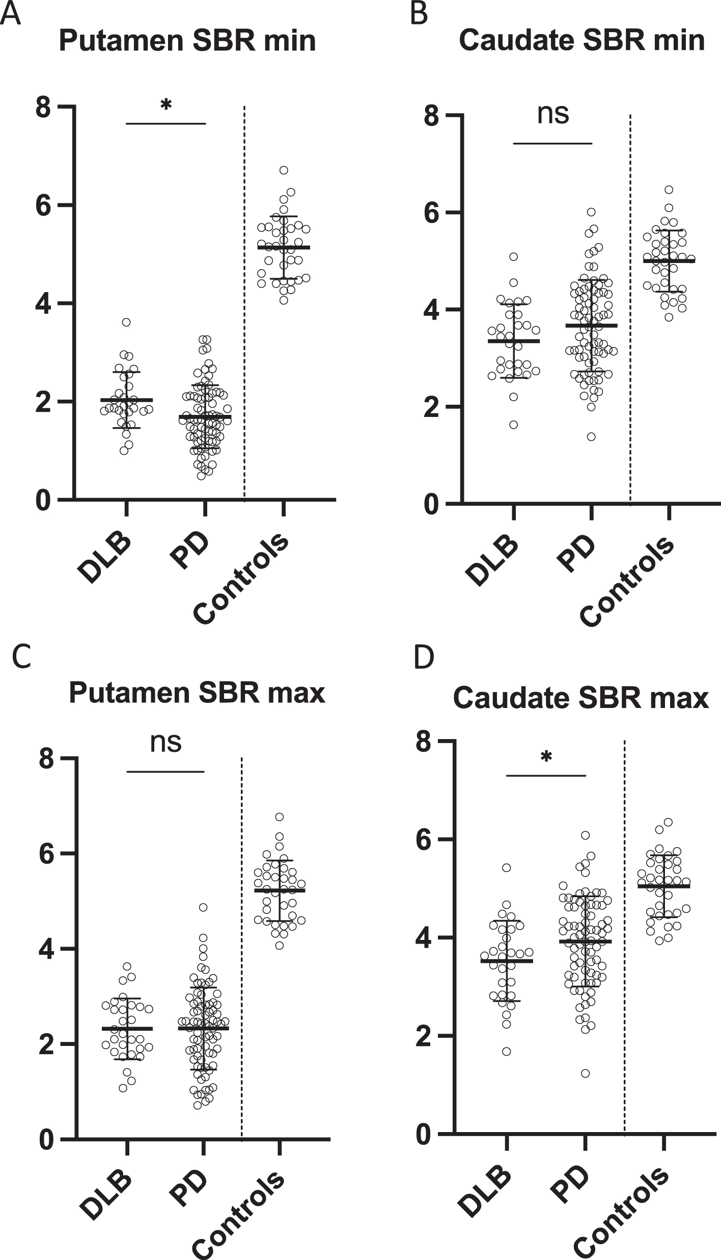 Most affected specific binding ratio in A) putamen and B) caudate in DLB patients, PD patients, and controls. Least affected specific binding ratio in D) putamen and E) caudate in DLB patients, PD patients, and controls. Data is presented as mean±SD. *p < 0.05. ns, non-significant; SBR, specific binding ratio.