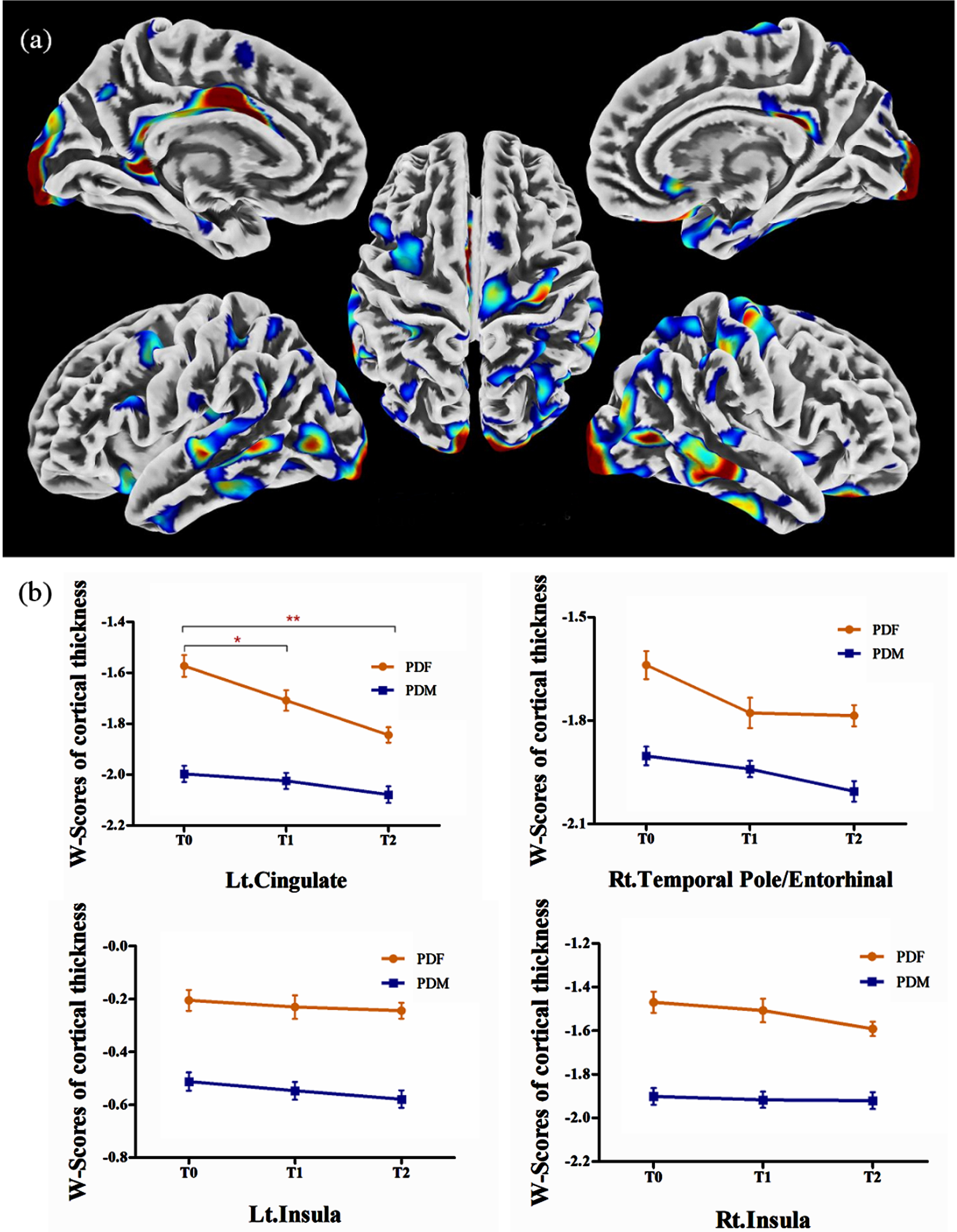 (a) Brain regions showed lower cortical thickness in males than in females in PD group 1; (b) in PD group 2, significantly lower cortical thickness in males than in females was observed in the left cingulate, the right temporal pole/entorhinal, and the bilateral insula, while no significant sex difference in longitudinal changes was observed. PDF, female PD patients; PDM, male PD patients; T0, baseline; T1, 12-month follow-up; T2, 24-month follow-up; Lt., left; Rt., right. *p < 0.05. **p < 0.001.