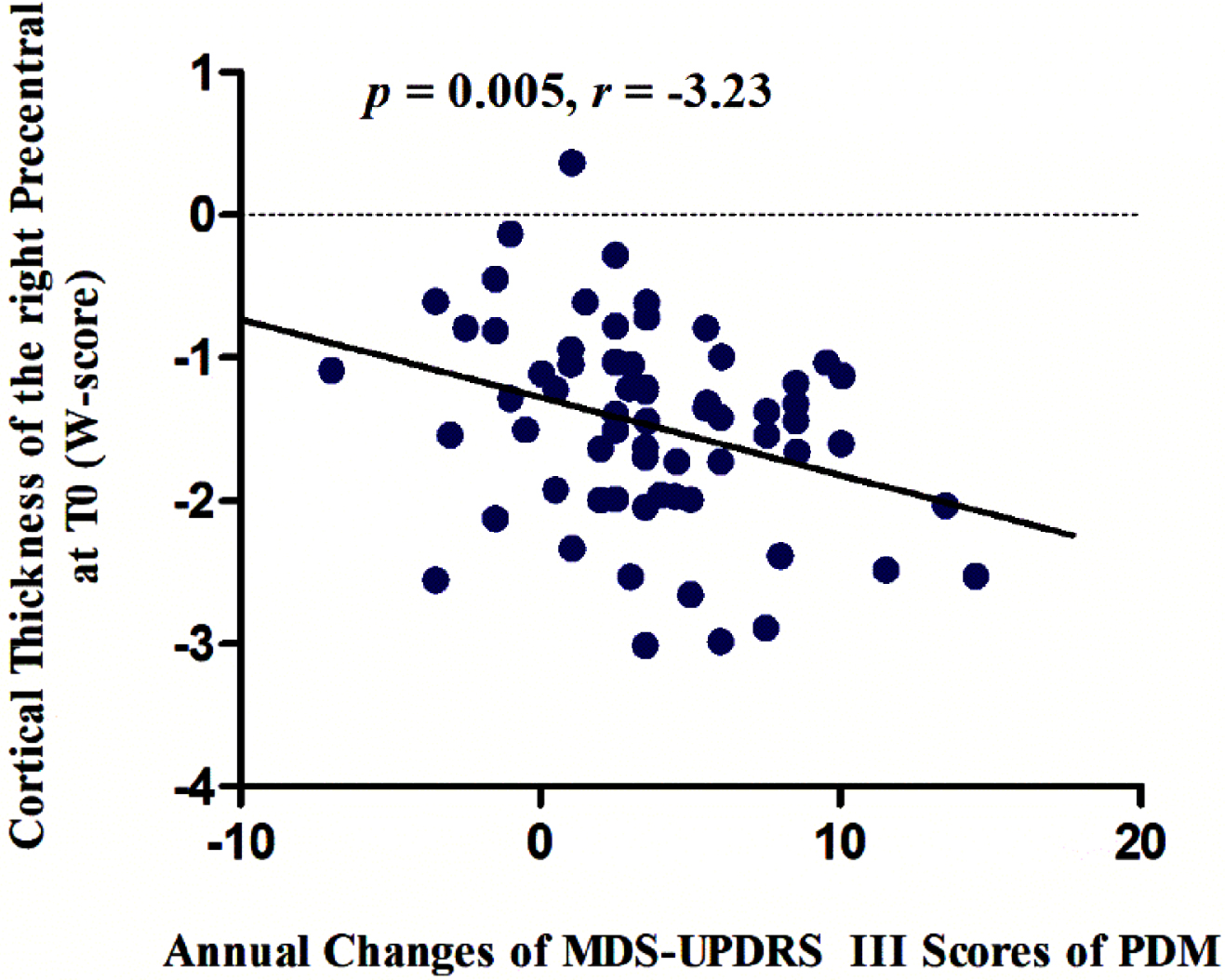 The cortical thickness of the right precentral gyrus at baseline was negatively associated with the annual changes in MDS-UPDRS Part III scores over time in male PD patients (p = 0.005, r = –3.23). MDS-UPDRS, Movement Disorder Society-Unified Parkinson’s Disease Rating Scale; PDM, male PD patients.