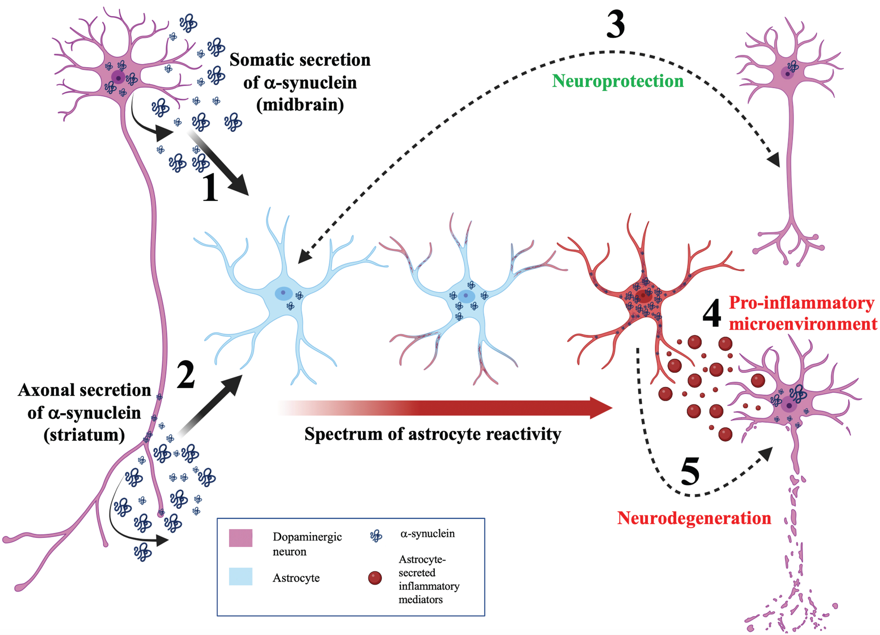 A neuroinflammatory model for astrocytic α-synuclein determining the balance between neuroprotection and neurodegeneration. Model schematic depicting a neuroinflammatory role for astrocytes in maintaining the balance between neuroprotection and neurodegeneration during PD. (1) α-synuclein is secreted by the soma of neurons and internalized by astrocytes. This somatodendritic neuron-astrocyte coupling may be seen in the midbrain. (2) α-synuclein is externalized by the axon of neurons and internalized by astrocytes. This morphological coupling may be seen in the striatum. (3) Bidirectional, efficient transfer of α-synuclein between astrocytes and neurons facilitates neuroprotection. (4) Aberrant α-synuclein accumulation induces astrocyte reactivity. Depending on the load of α-synuclein in the astrocyte, astrocyte reactivity can range from mild (blue astrocyte) to moderate (astrocyte with red process tips) to severe reactivity (red astrocyte). (5) Highly reactive astrocytes will secrete cytokines (red vesicles) resulting in a pro-inflammatory microenvironment and consequent neurodegeneration. In addition, transfer of α-synuclein from astrocytes to neurons can induce neurodegeneration.