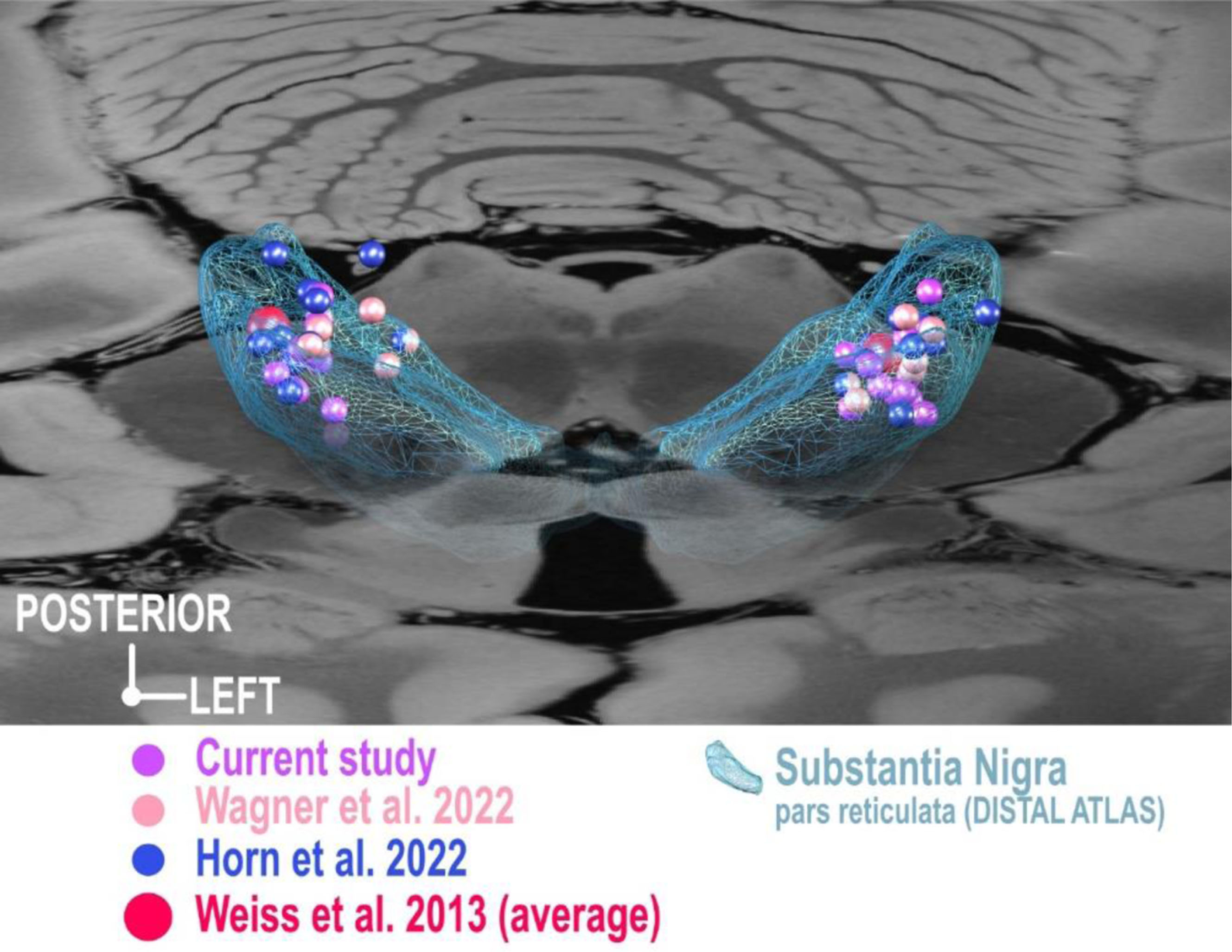 3D-visualization of previously published coordinates of electrodes targeting the substantia nigra from two studies [15, 17] as well as the cohort average of one study [18]. As coordinates for these studies were reported relative to AC-PC, an established conversion algorithm [62] was used to project coordinates into a common space (MNI) and relative to the substantia nigra atlas structure as defined by the DISTAL atlas [32] superimposed on a slice of 7 Tesla MRI of ex vivo human brain at 200 micron resolution [61]. Note that coordinates aggregate in the dorsolateral substantia nigra or even dorsal to the substantia nigra within the region of the subthalamic nucleus.
